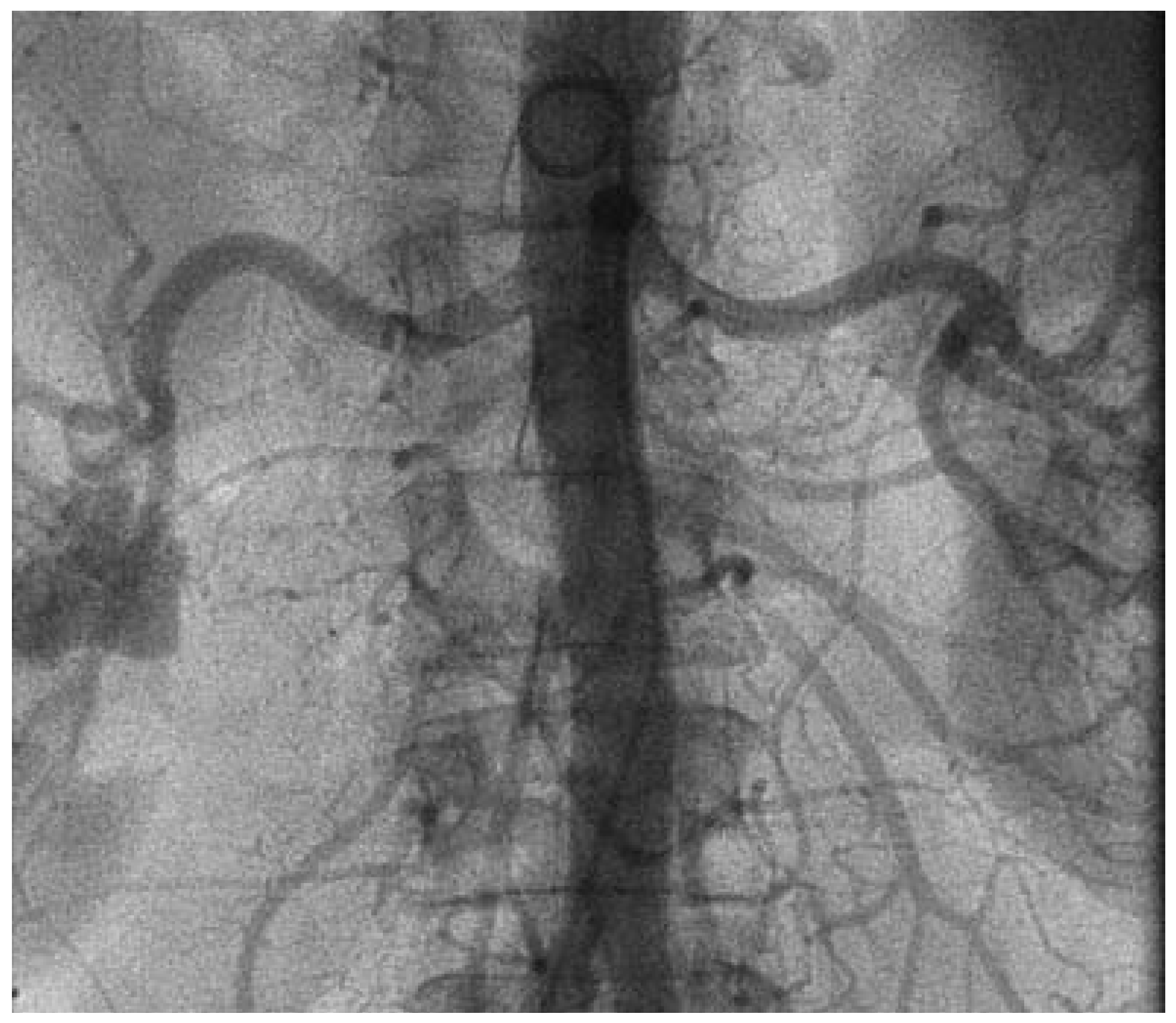 Cardiovascmed 13 00346 g003