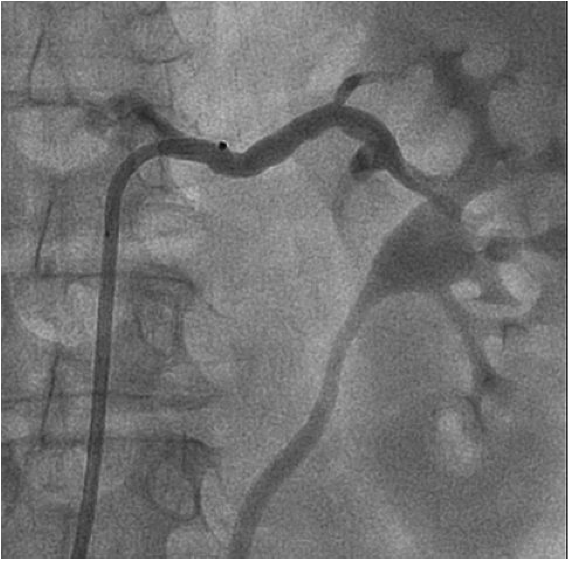 Cardiovascmed 13 00346 g006