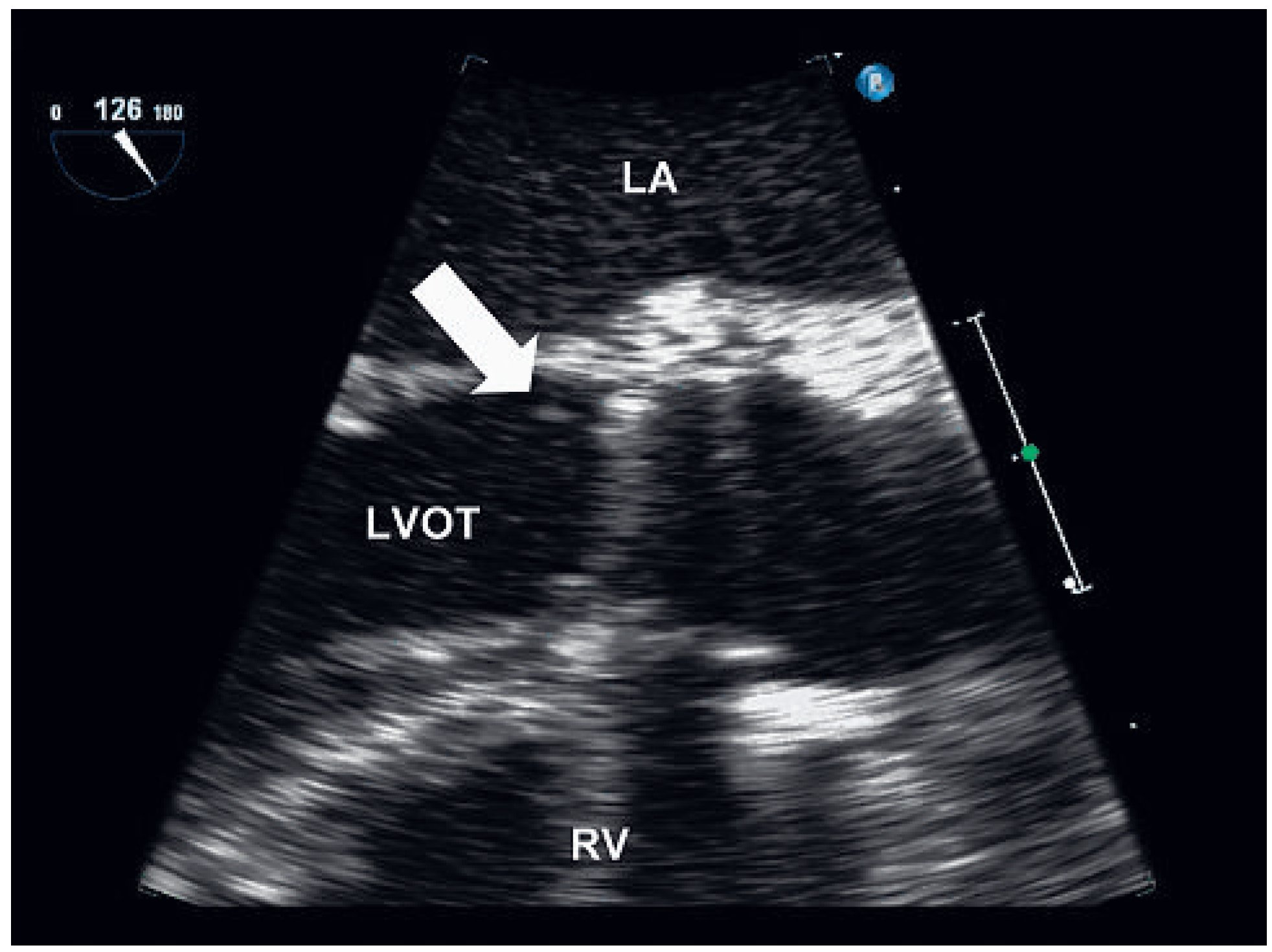 Cardiovascmed 13 00350 g001