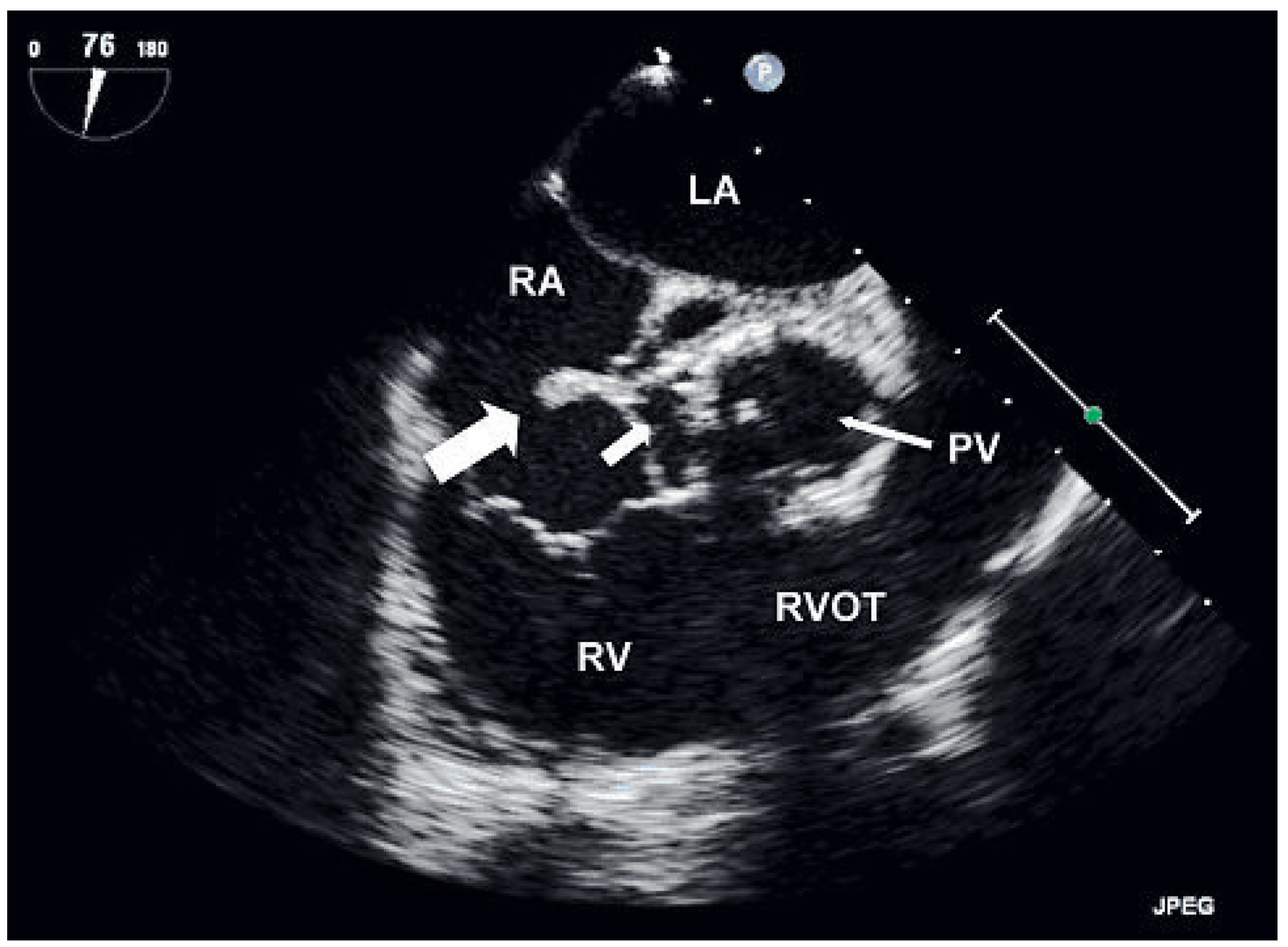 Cardiovascmed 13 00350 g002