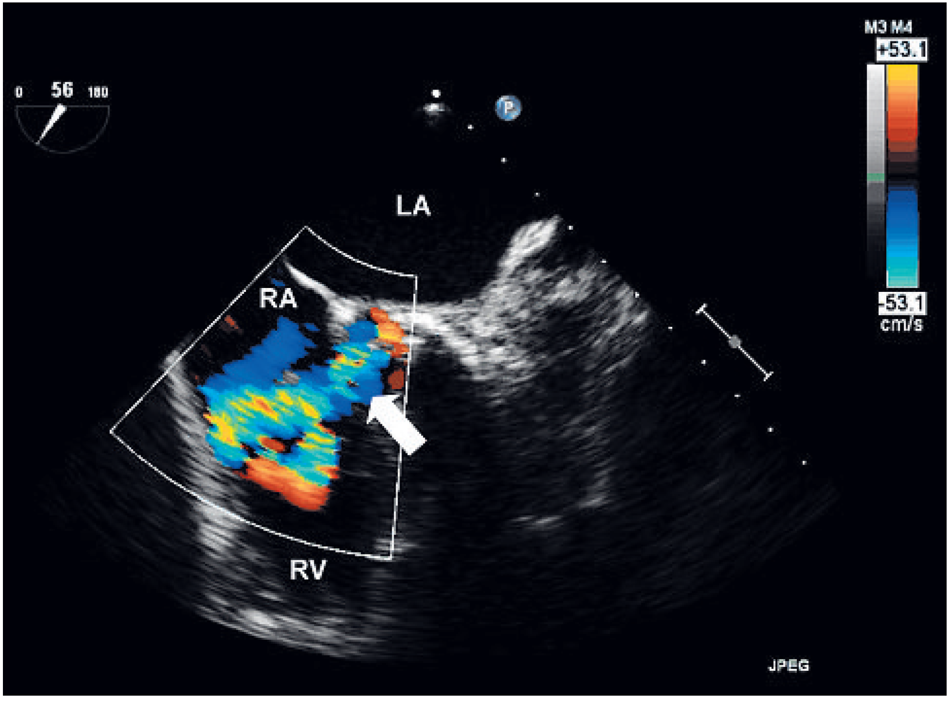 Cardiovascmed 13 00350 g003