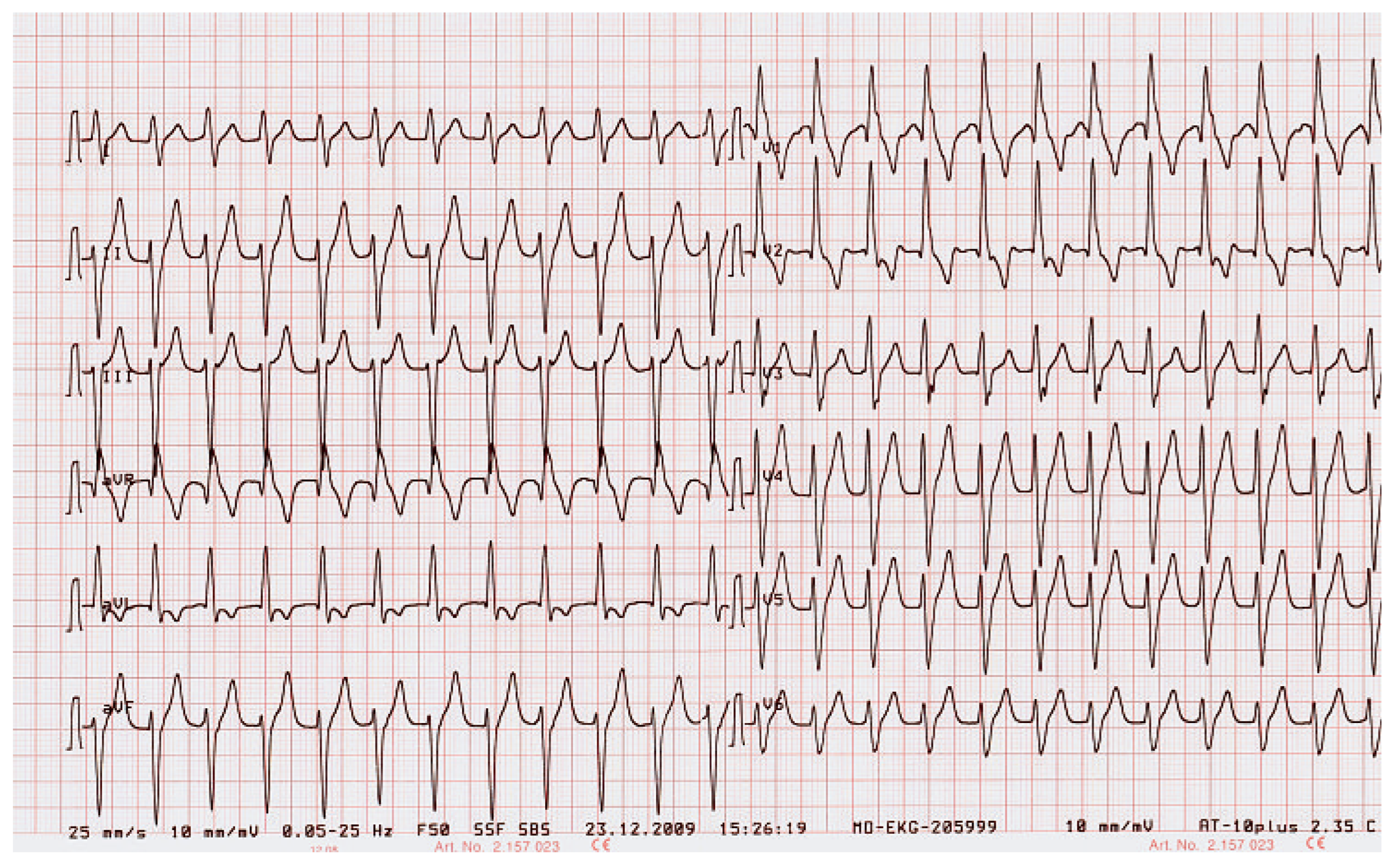 Cardiovascmed 13 00352 g001
