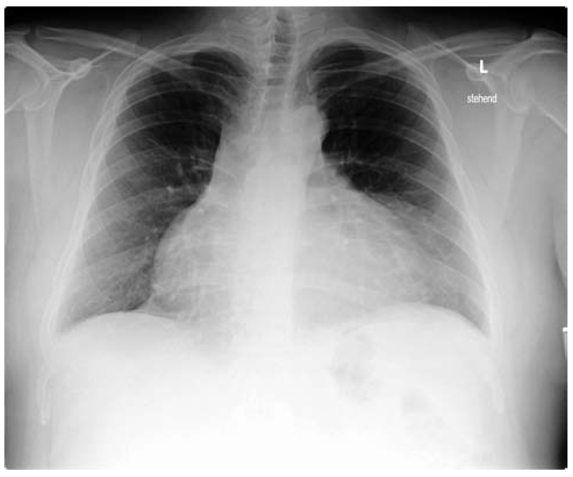 Cardiovascmed 13 00376 g001 Cardiovascmed 13 00376 g001