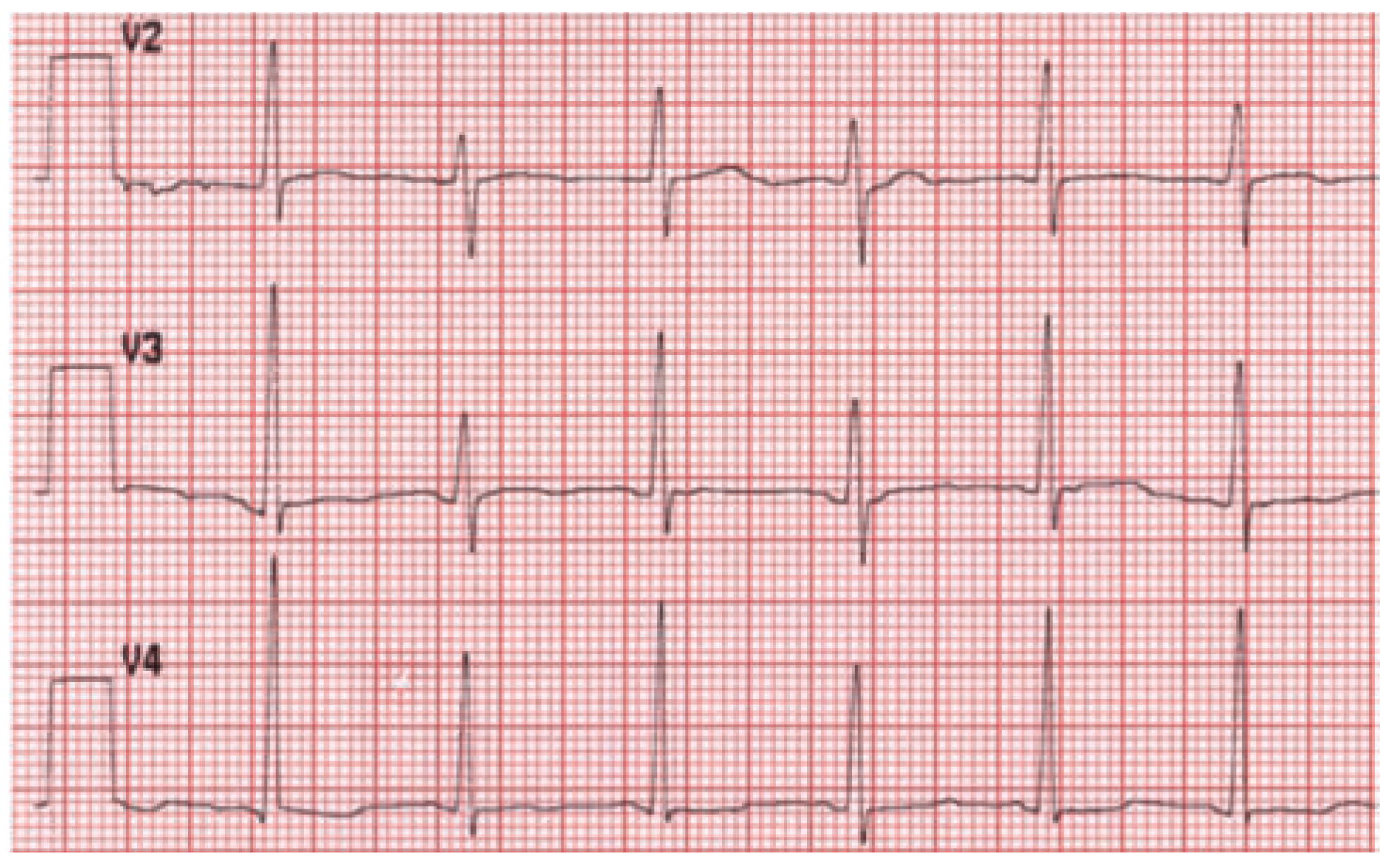 Cardiovascmed 13 00376 g002 Cardiovascmed 13 00376 g002