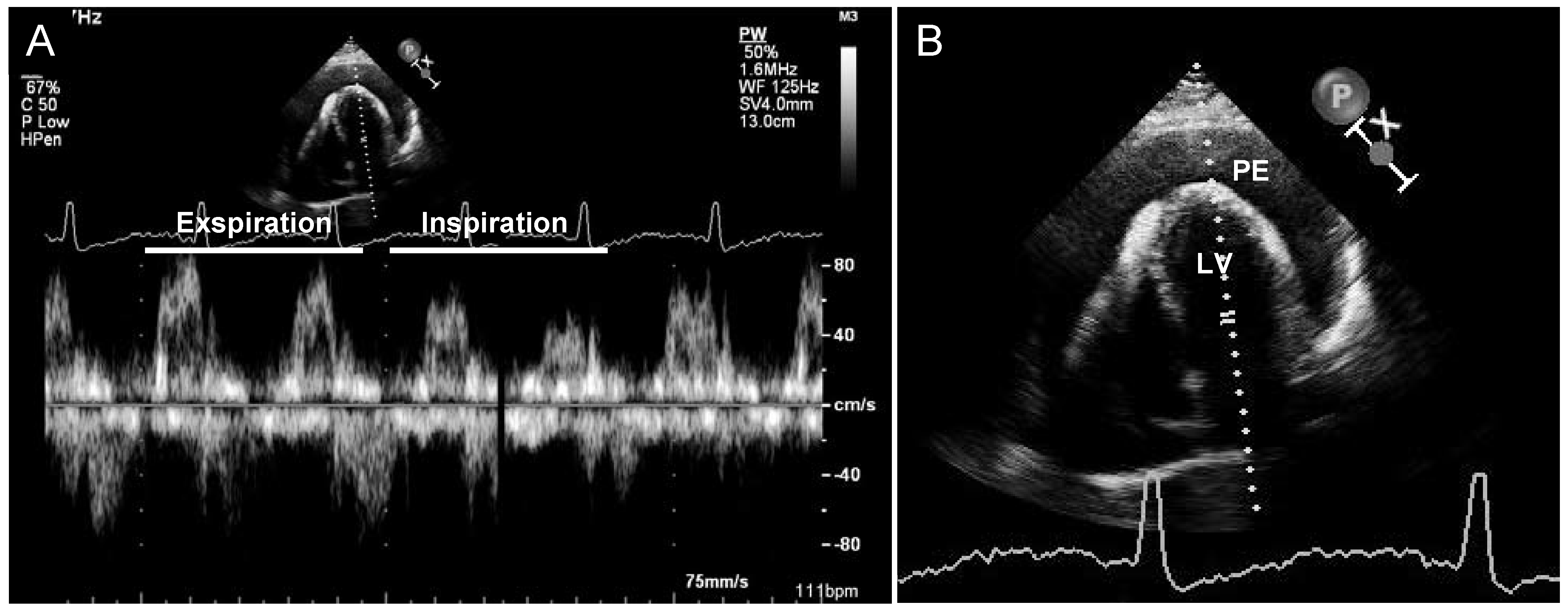 Cardiovascmed 13 00376 g003 Cardiovascmed 13 00376 g003