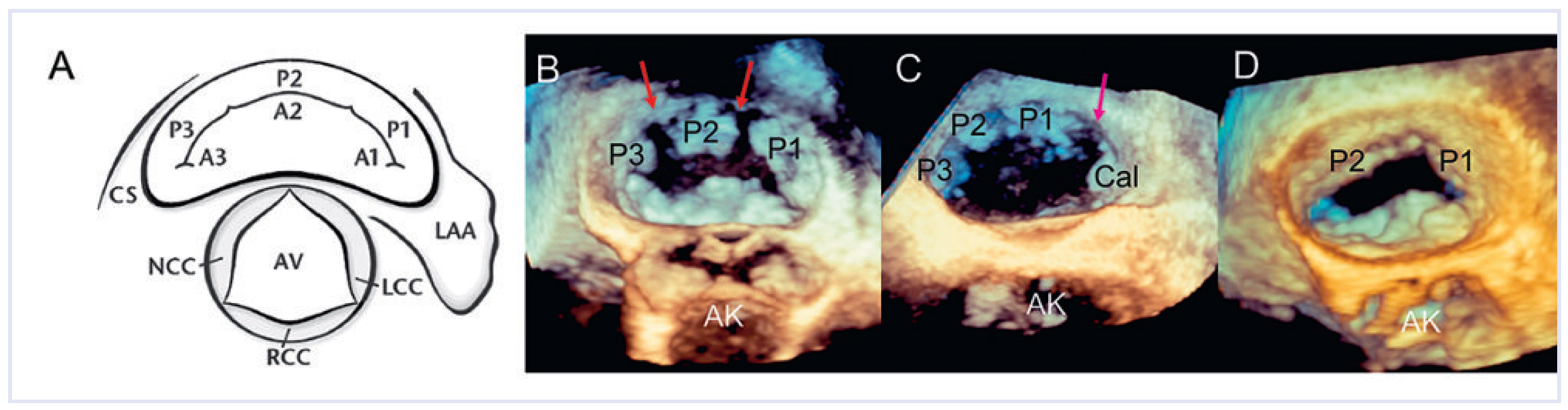 Cardiovascmed 14 00004 g002 Cardiovascmed 14 00004 g002