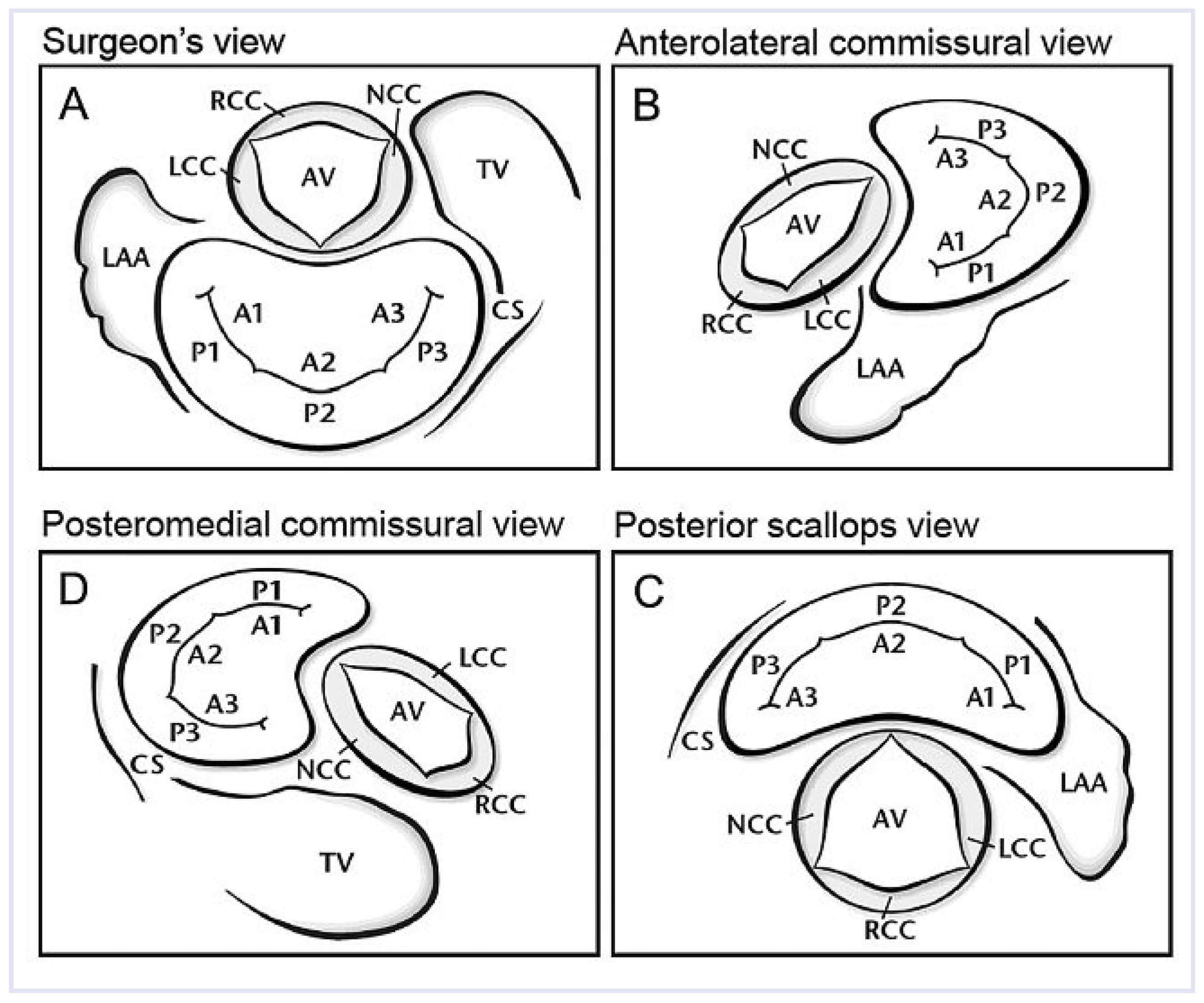 Cardiovascmed 14 00004 g005 Cardiovascmed 14 00004 g005