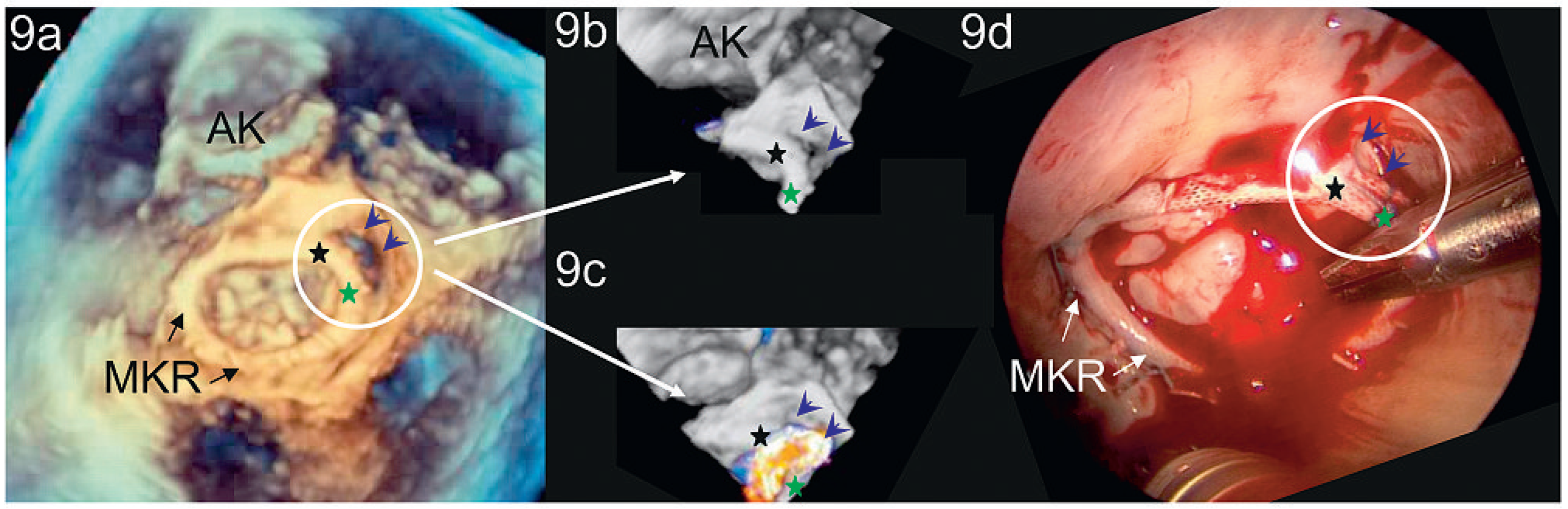 Cardiovascmed 14 00004 g009 Cardiovascmed 14 00004 g009