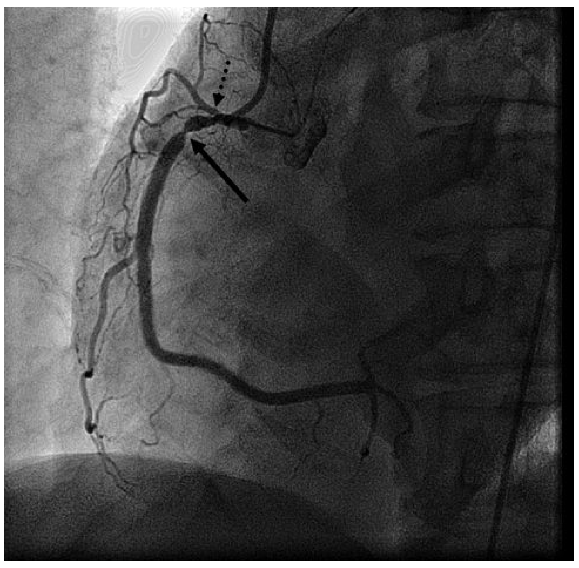 Cardiovascmed 14 00024 g001