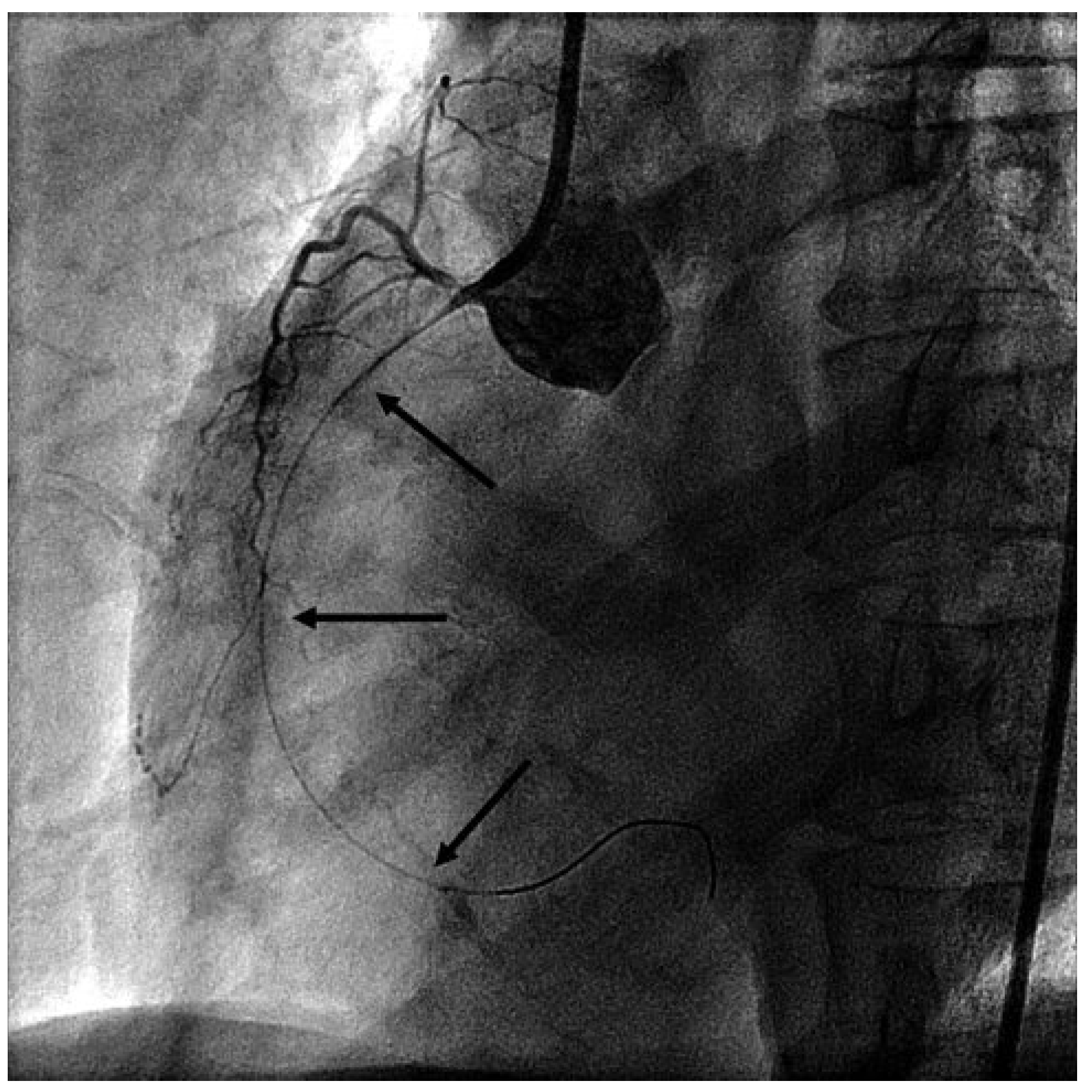 Cardiovascmed 14 00024 g002