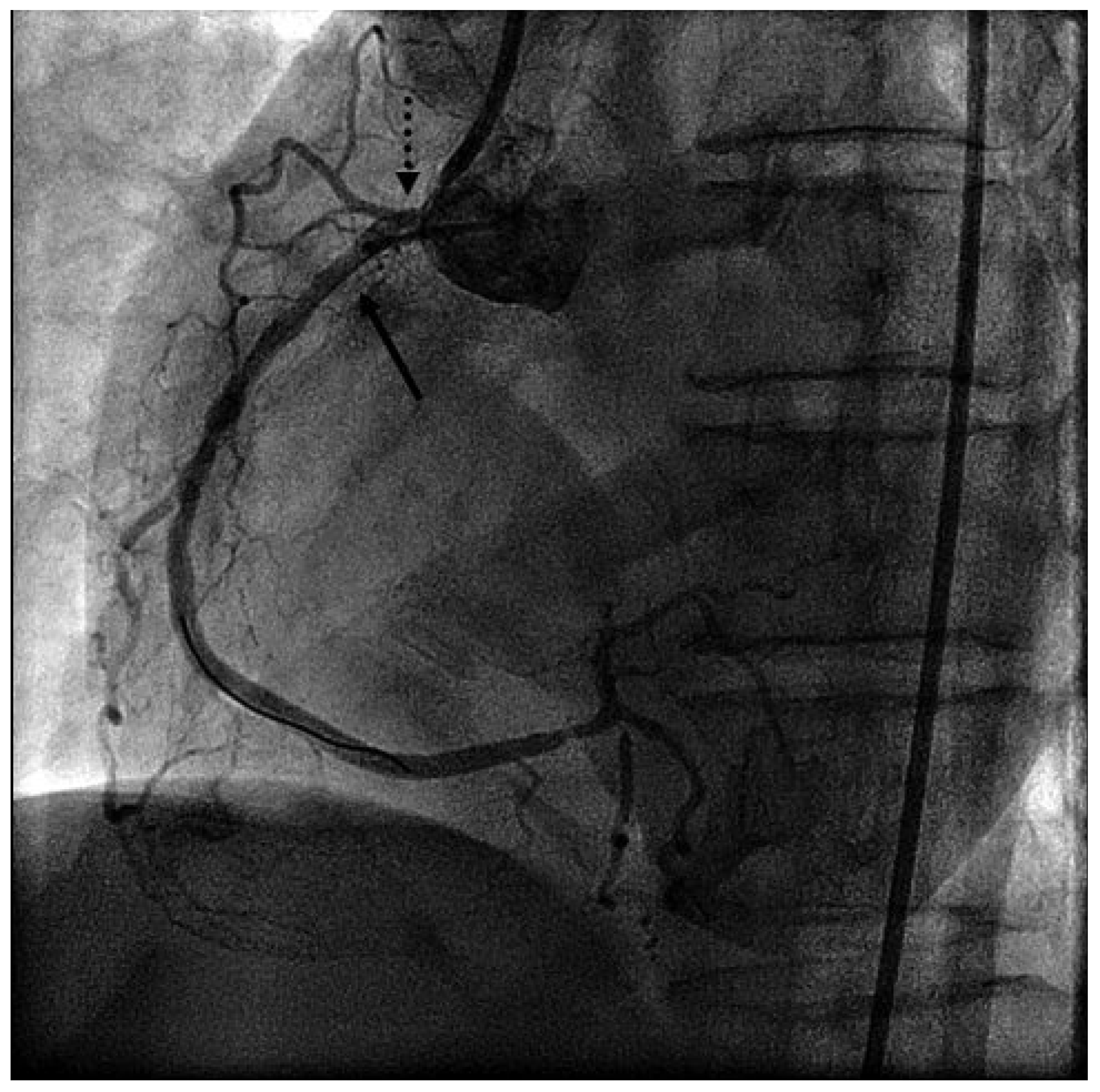 Cardiovascmed 14 00024 g003