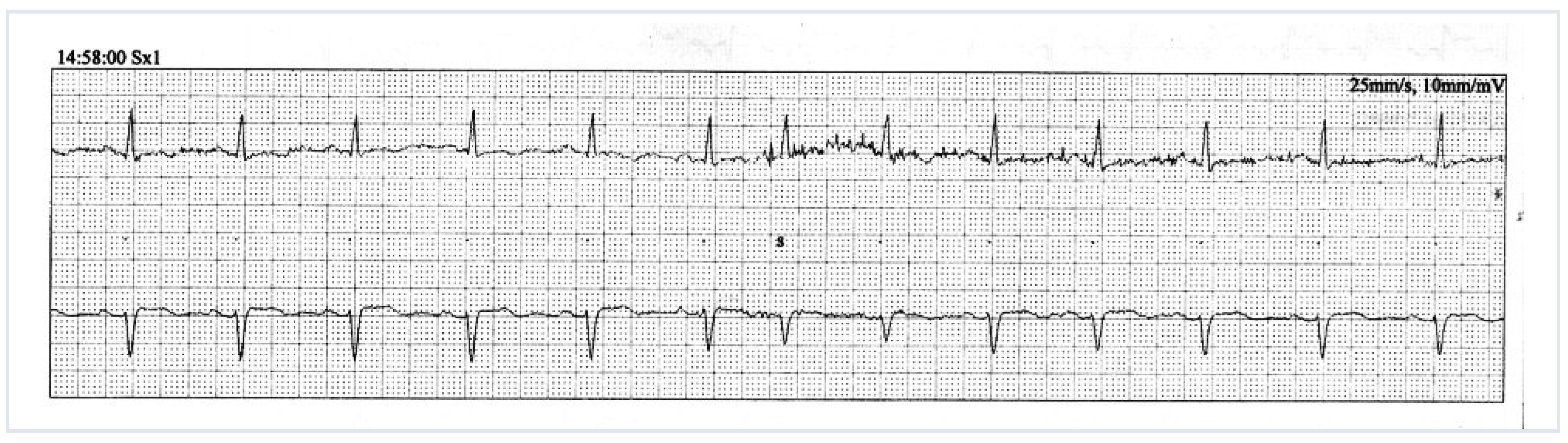 Cardiovascmed 14 00027 g002 Cardiovascmed 14 00027 g002