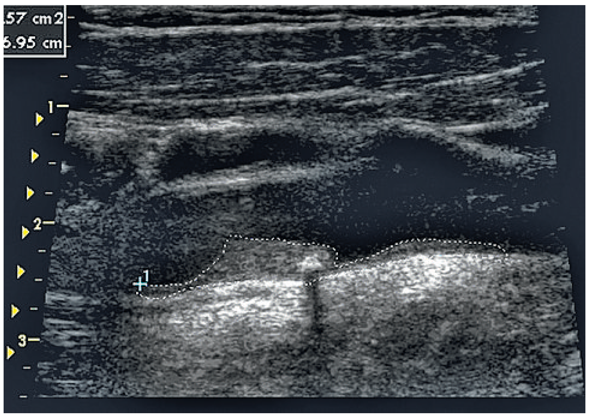 Cardiovascmed 14 00053 g001 Cardiovascmed 14 00053 g001