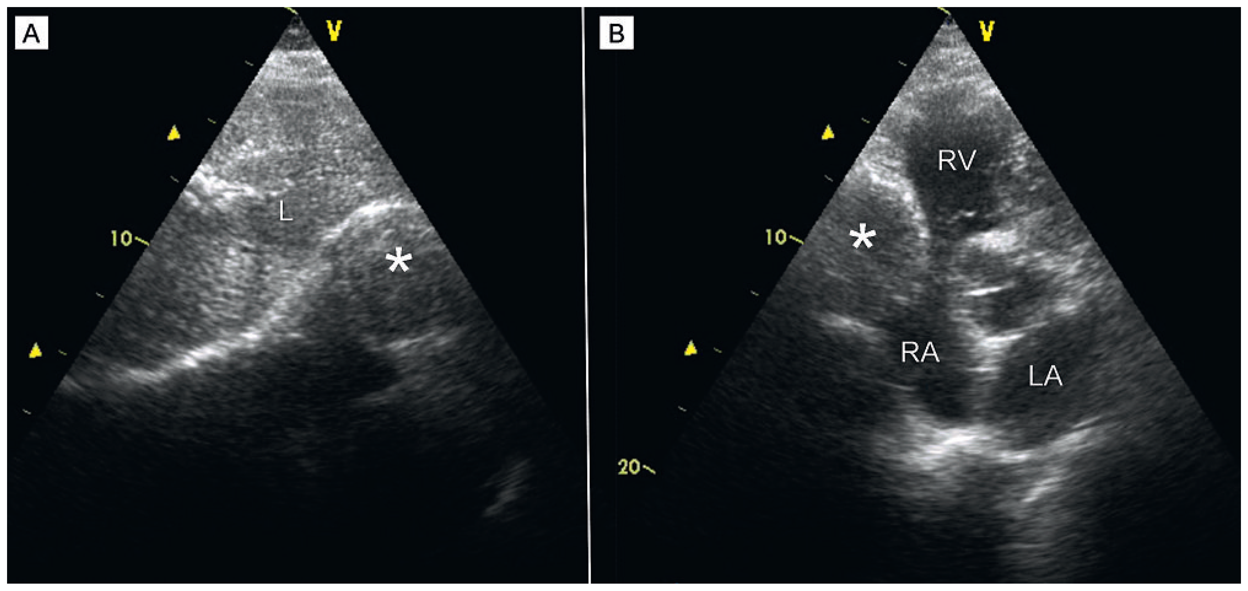 Cardiovascmed 14 00069 g001 Cardiovascmed 14 00069 g001
