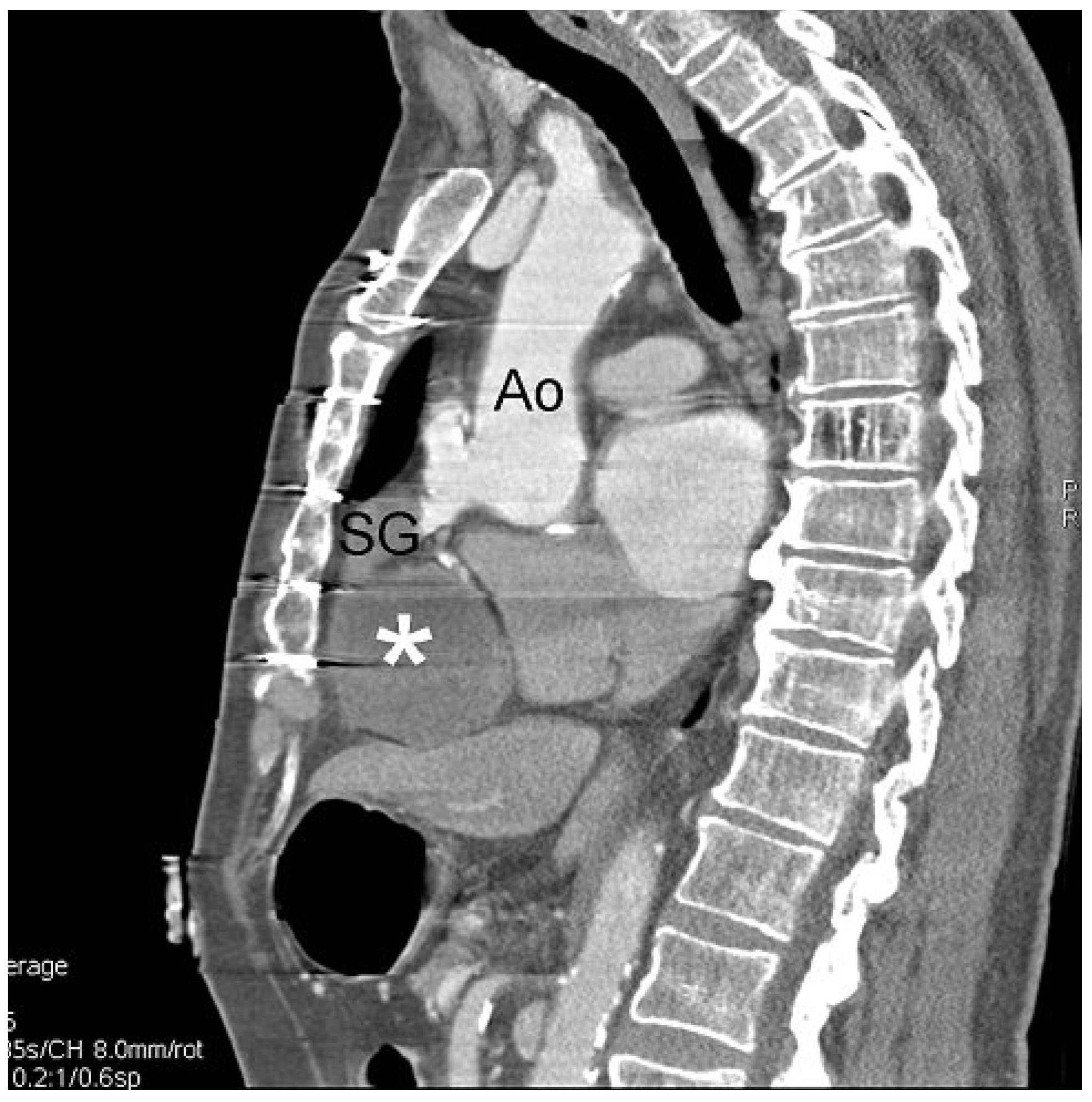 Cardiovascmed 14 00069 g002 Cardiovascmed 14 00069 g002