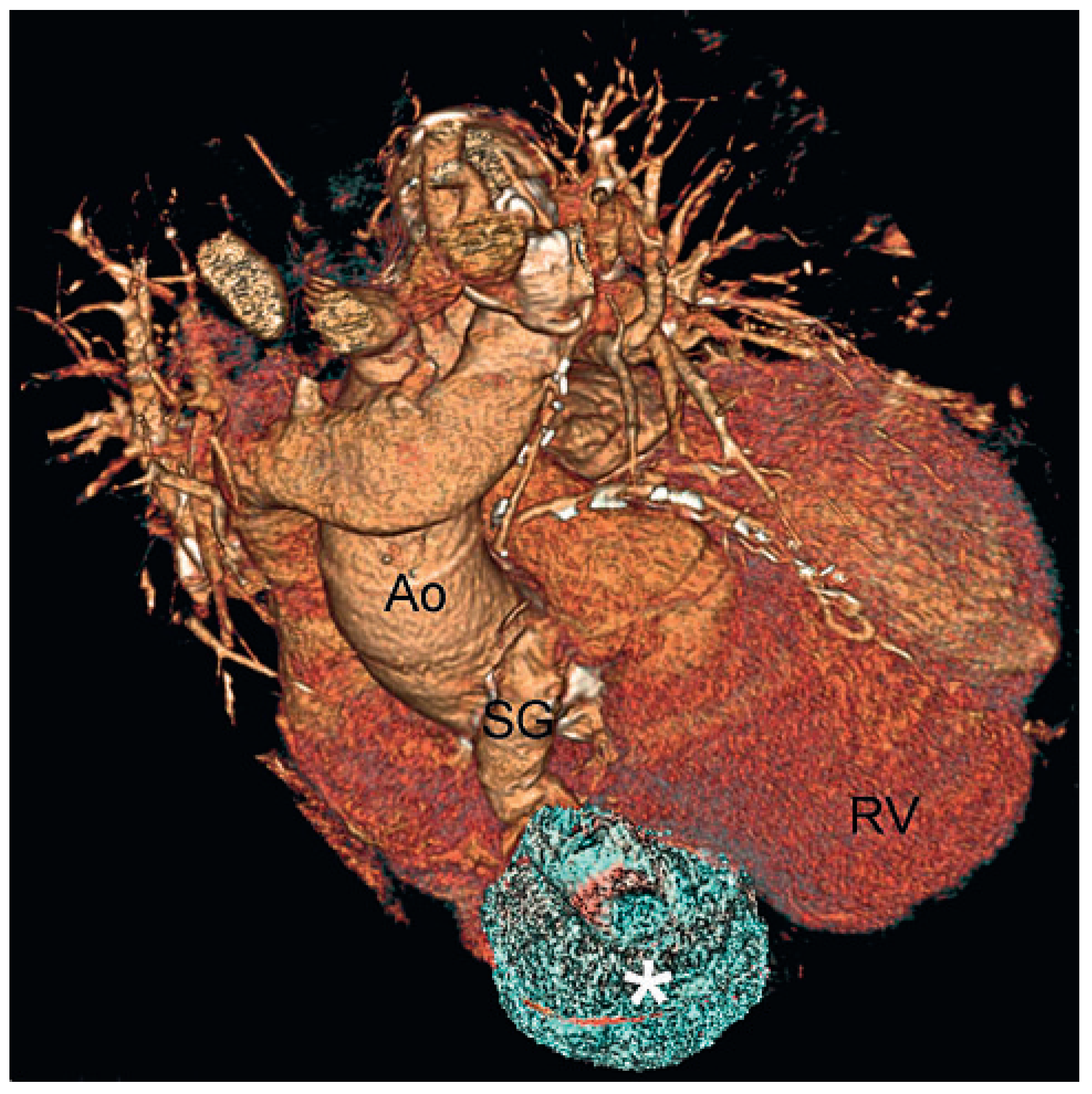 Cardiovascmed 14 00069 g003 Cardiovascmed 14 00069 g003
