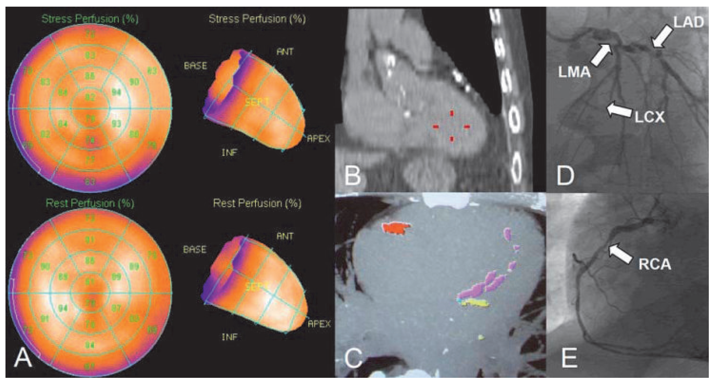 Cardiovascmed 14 00075 g007 Cardiovascmed 14 00075 g007