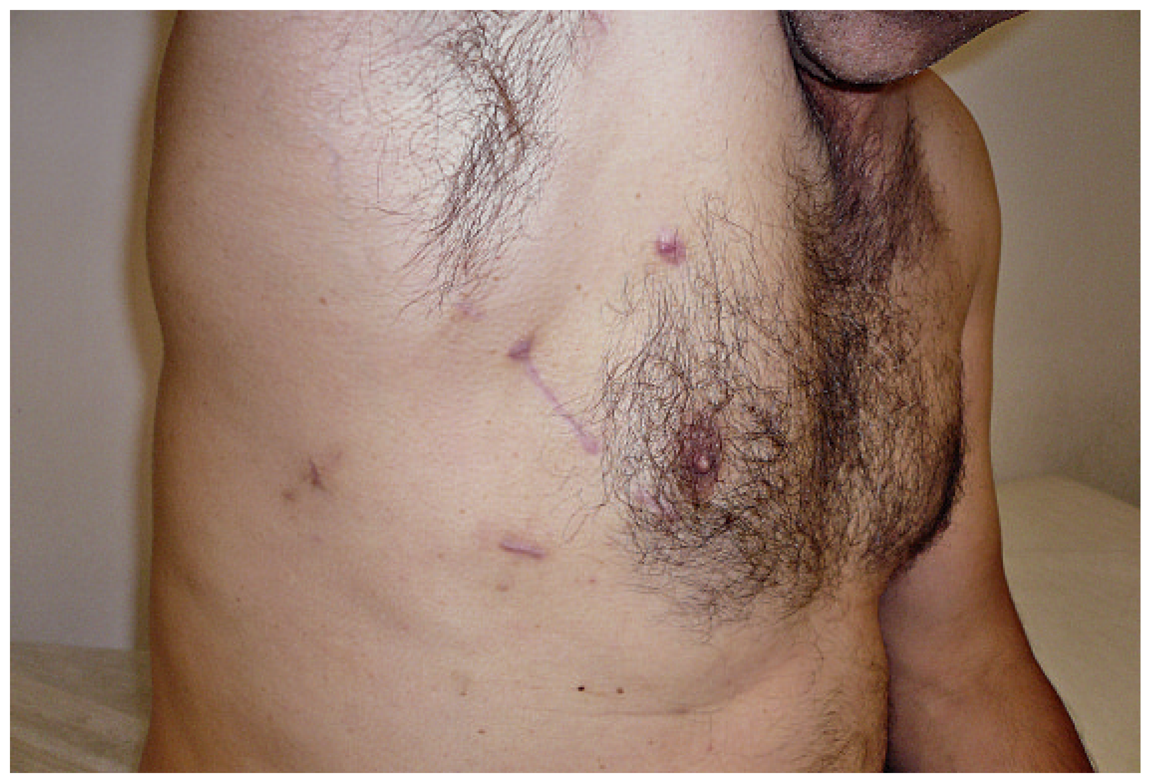 Cardiovascmed 14 00092 g001 Cardiovascmed 14 00092 g001