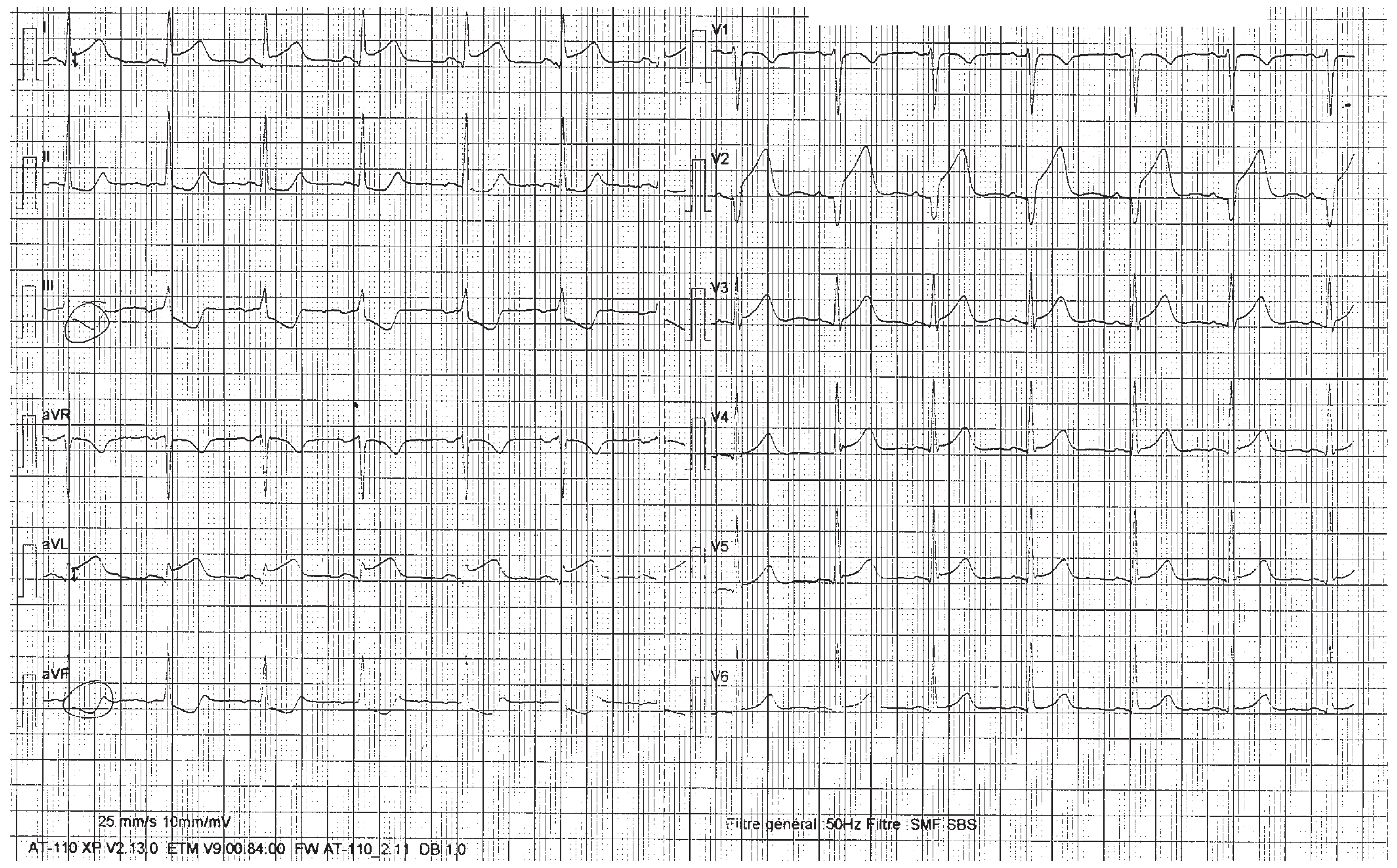 Cardiovascmed 14 00095 g001 Cardiovascmed 14 00095 g001