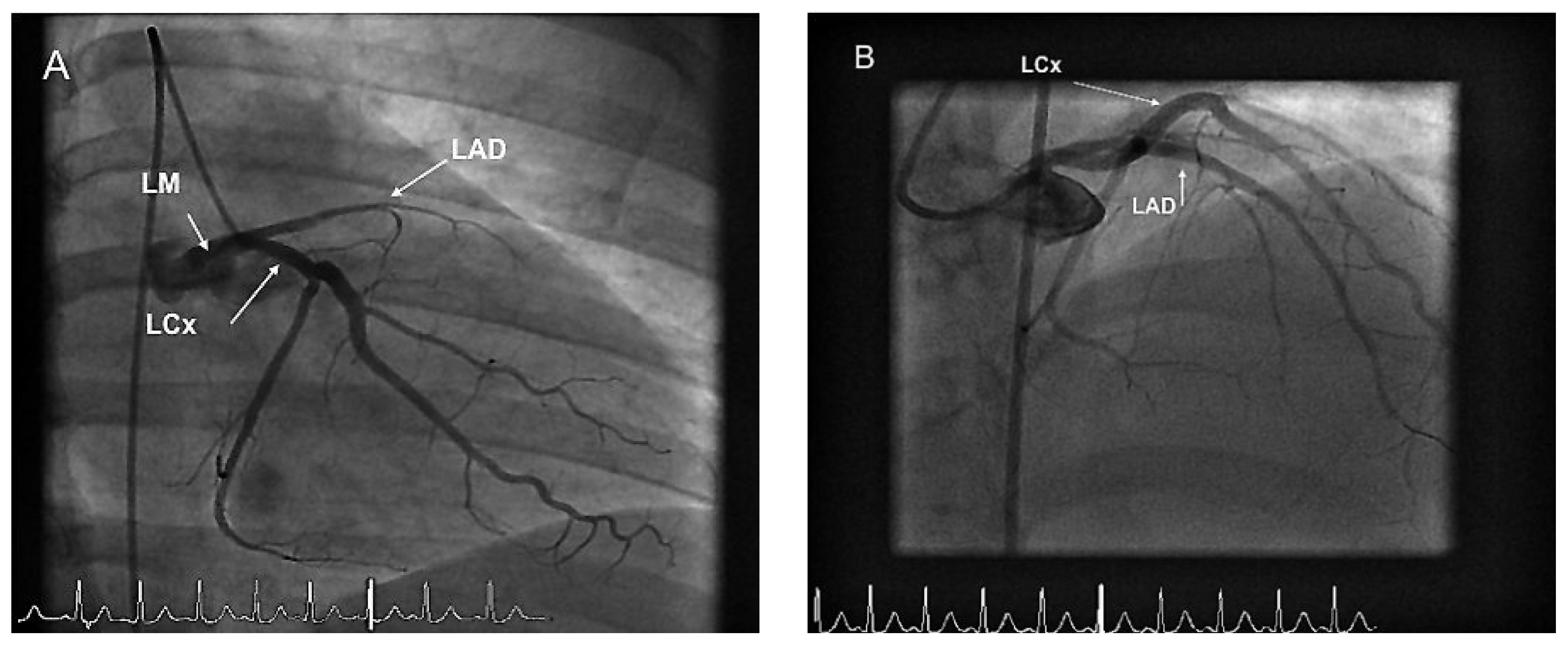 Cardiovascmed 14 00095 g002 Cardiovascmed 14 00095 g002