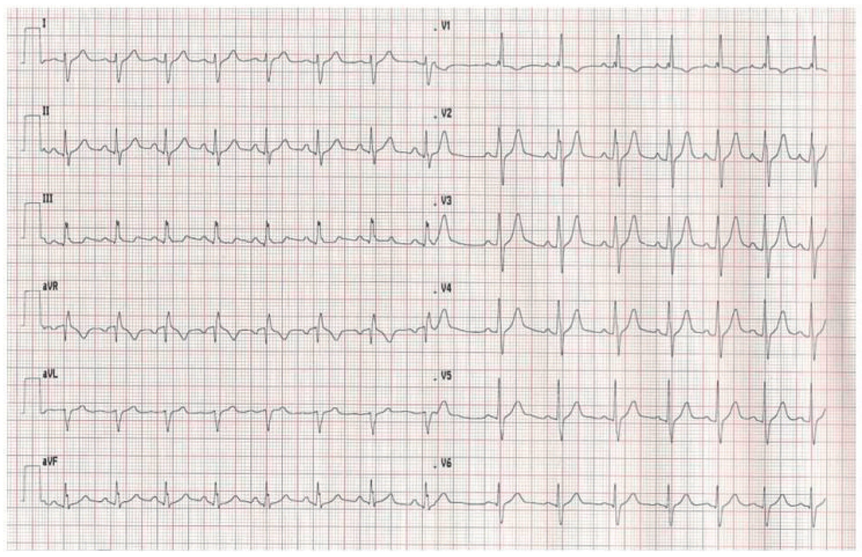 Cardiovascmed 14 00098 g001 Cardiovascmed 14 00098 g001