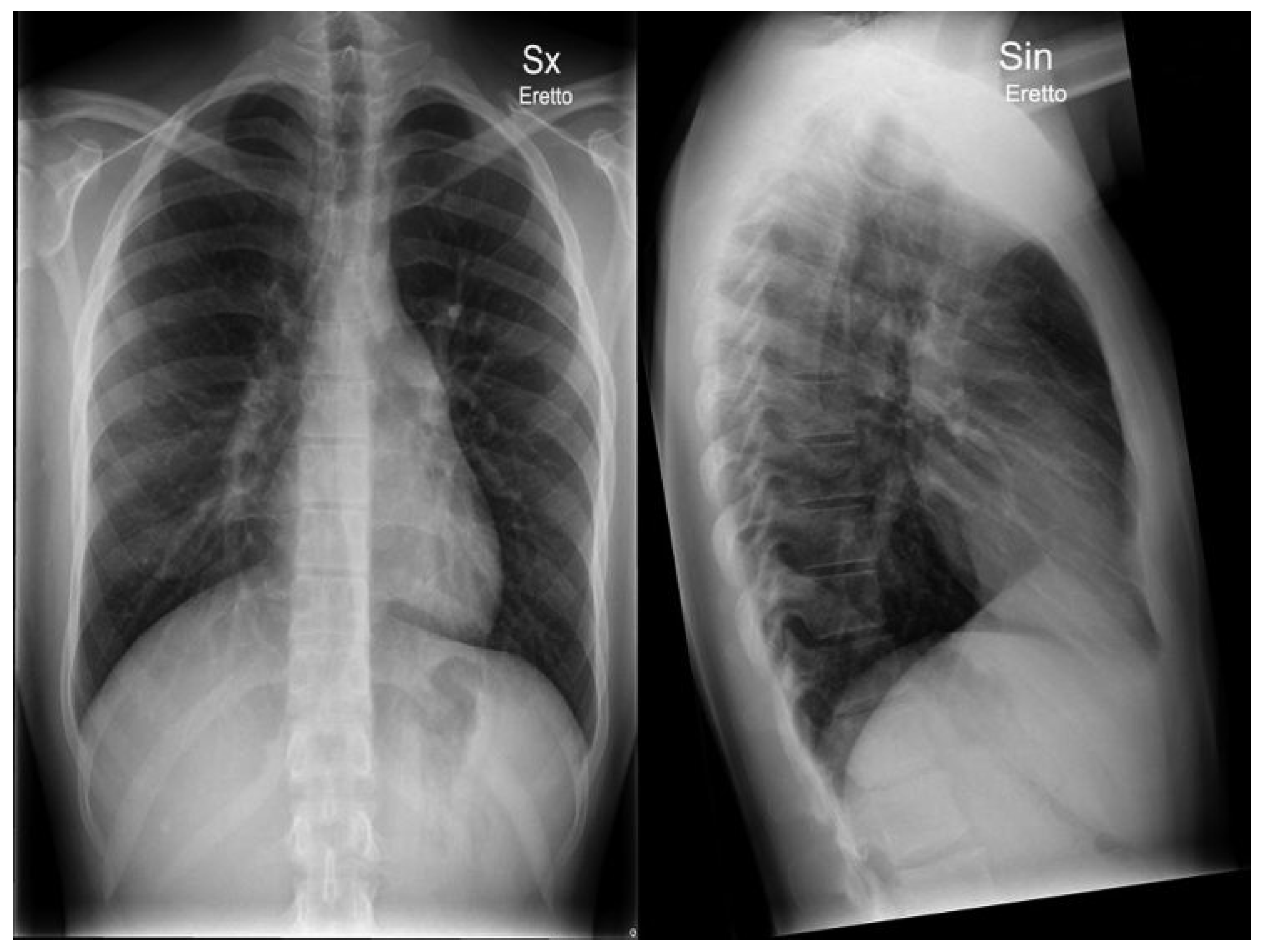 Cardiovascmed 14 00098 g002 Cardiovascmed 14 00098 g002