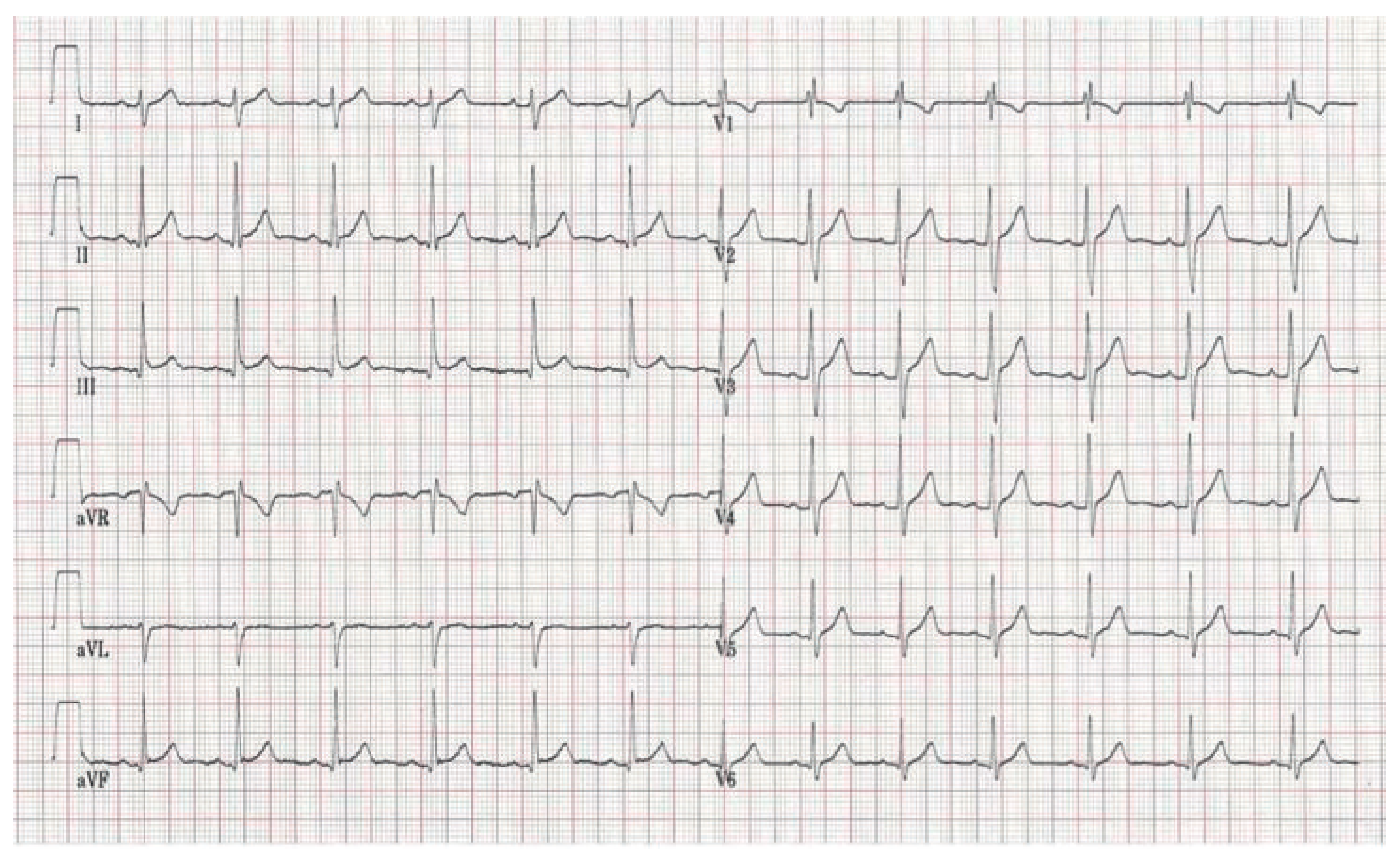 Cardiovascmed 14 00098 g004 Cardiovascmed 14 00098 g004