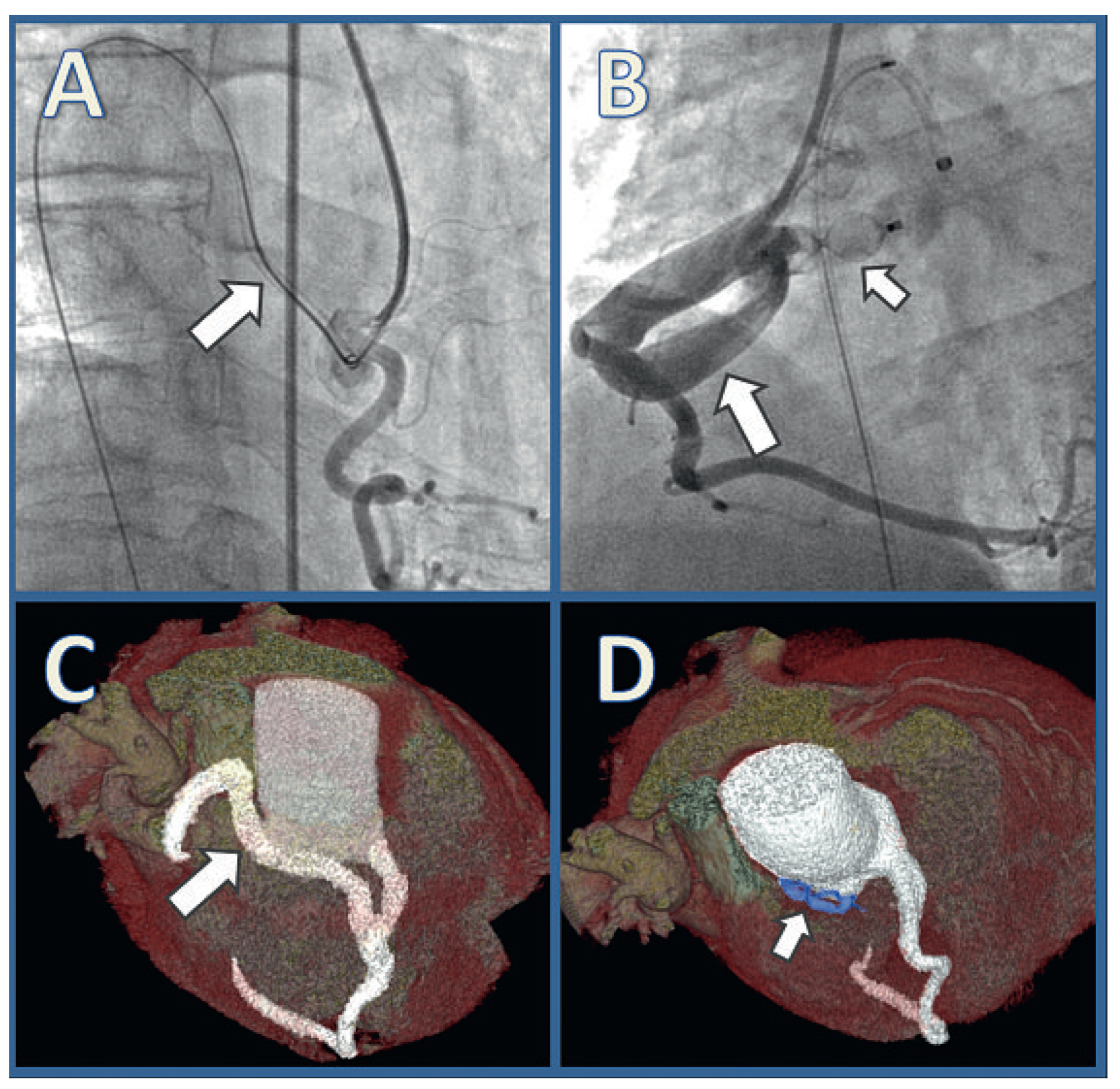 Cardiovascmed 14 00105 g001