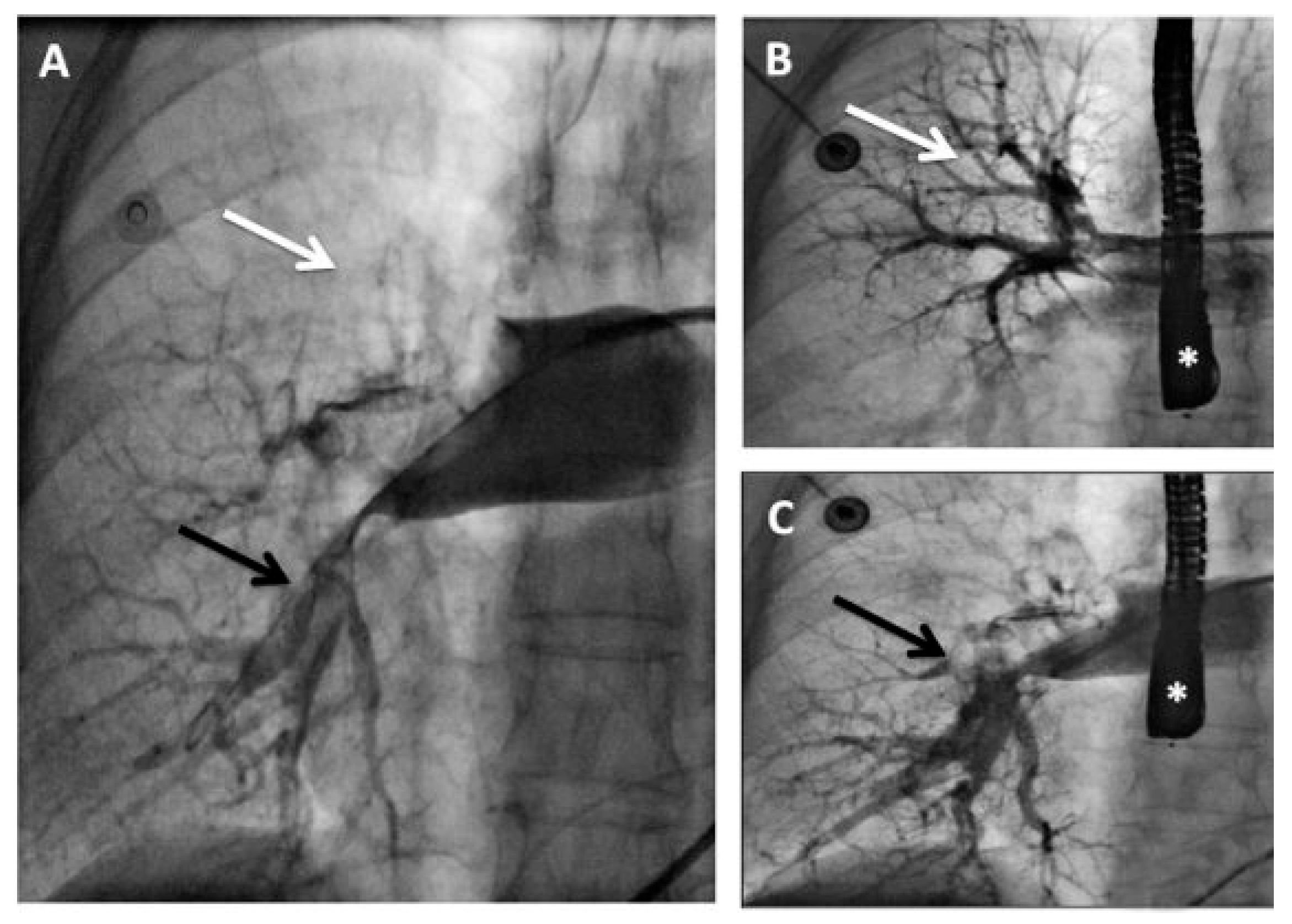 Cardiovascmed 14 00127 g003