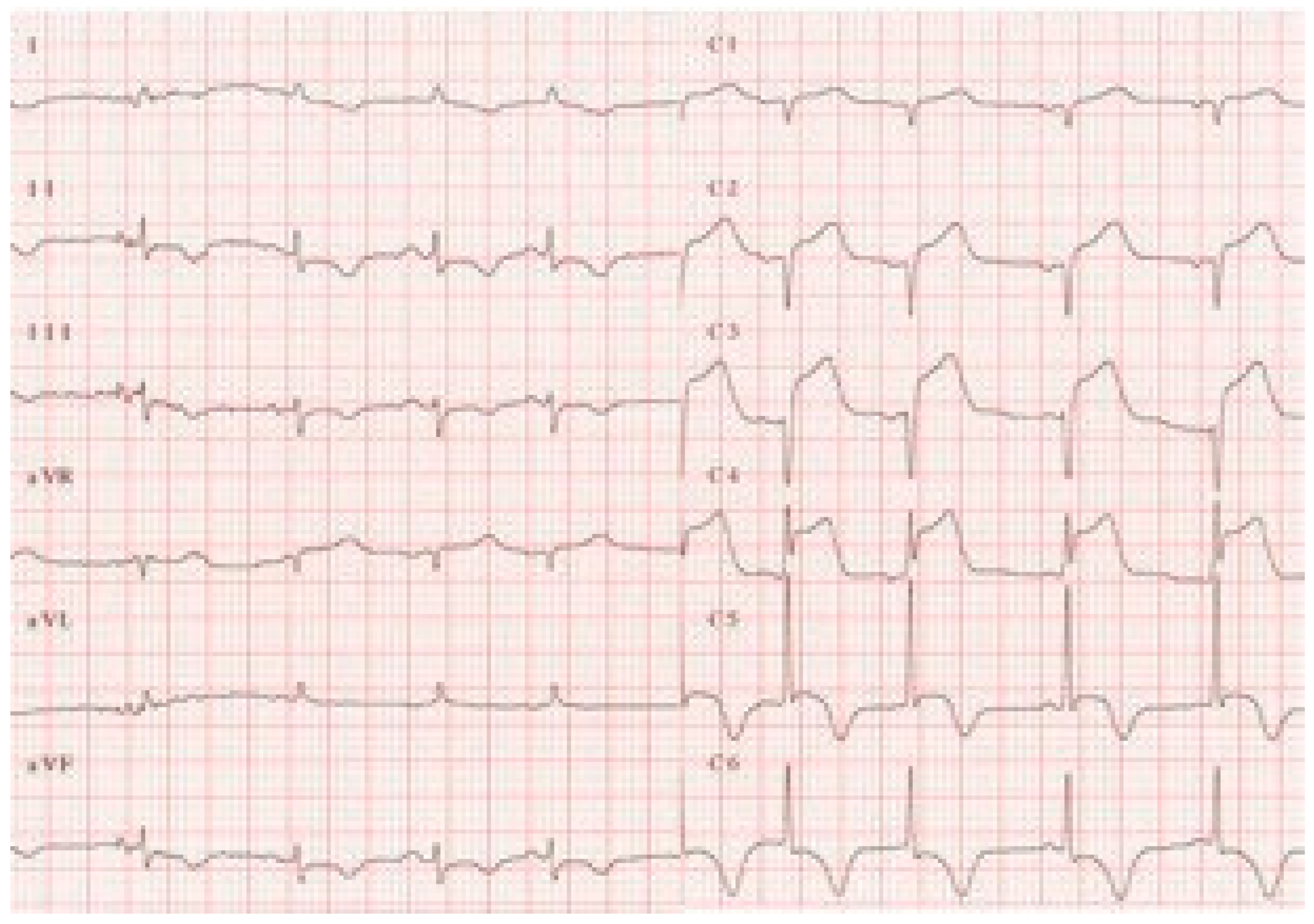 Cardiovascmed 14 00131 g002