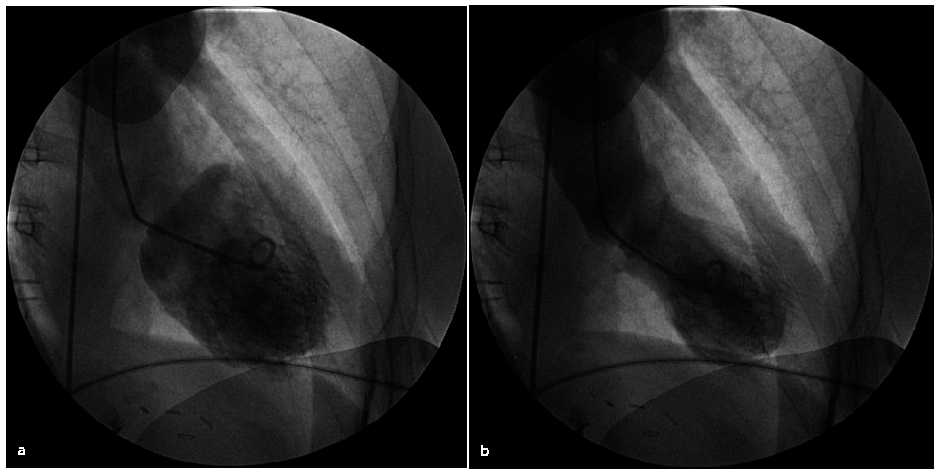 Cardiovascmed 14 00131 g004
