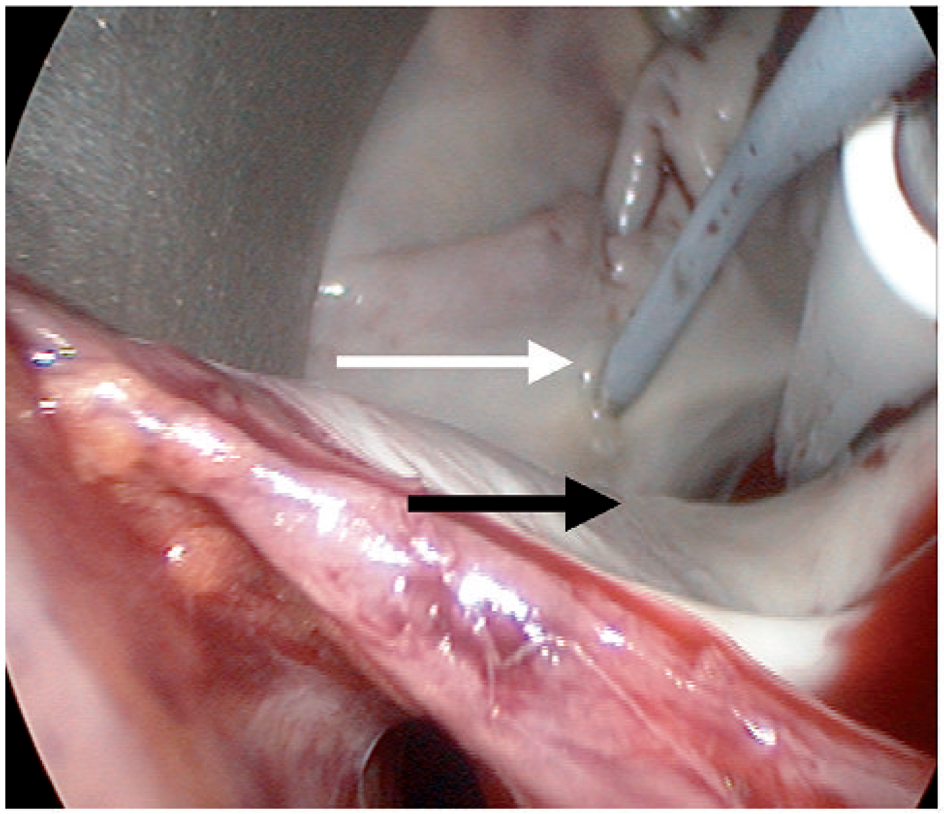 Cardiovascmed 14 00159 g001 Cardiovascmed 14 00159 g001