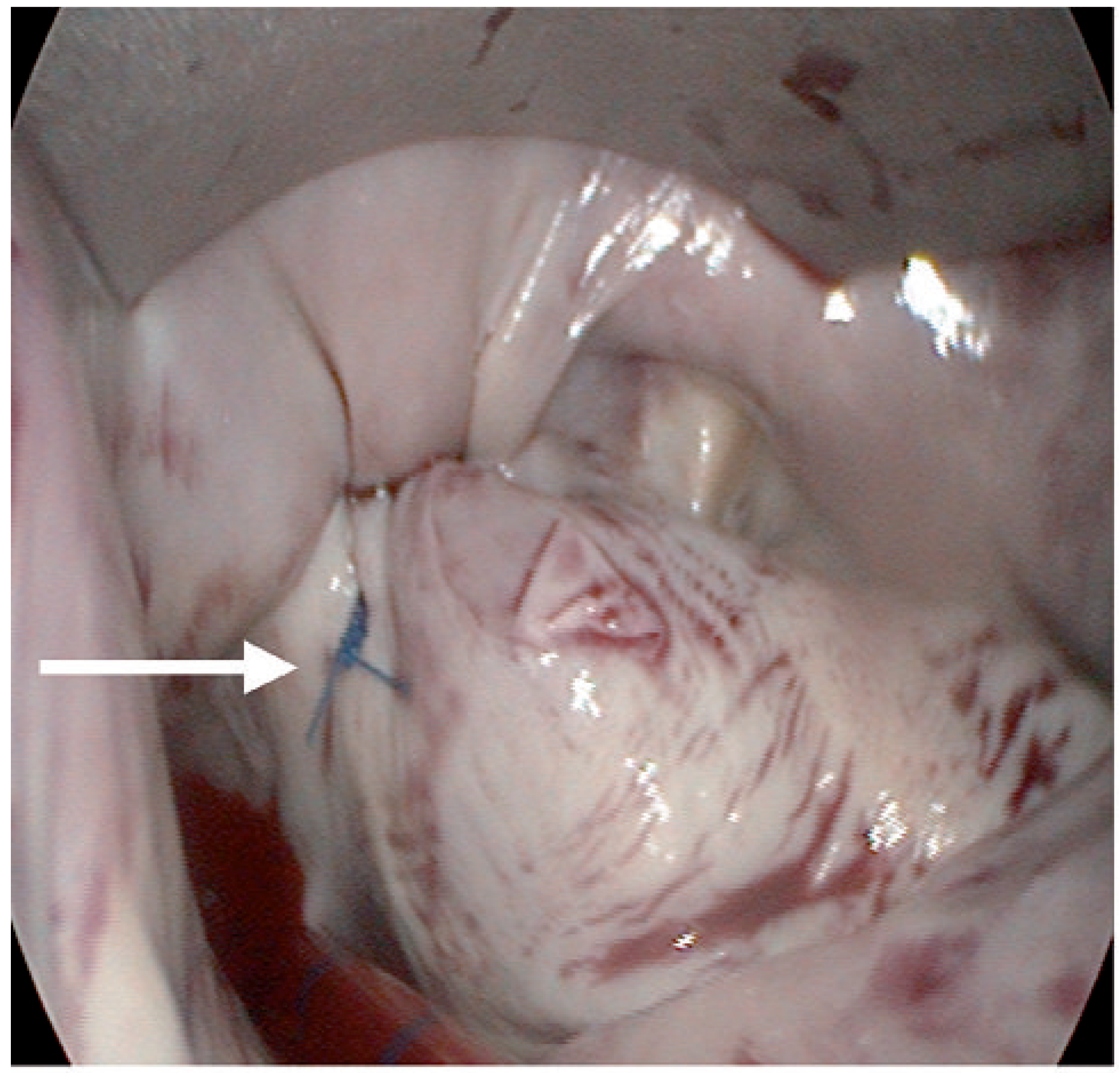 Cardiovascmed 14 00159 g002 Cardiovascmed 14 00159 g002