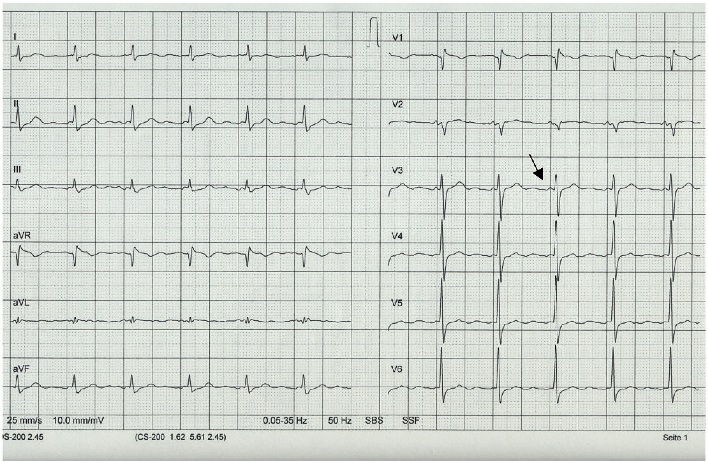 Cardiovascmed 14 00159 g004 Cardiovascmed 14 00159 g004