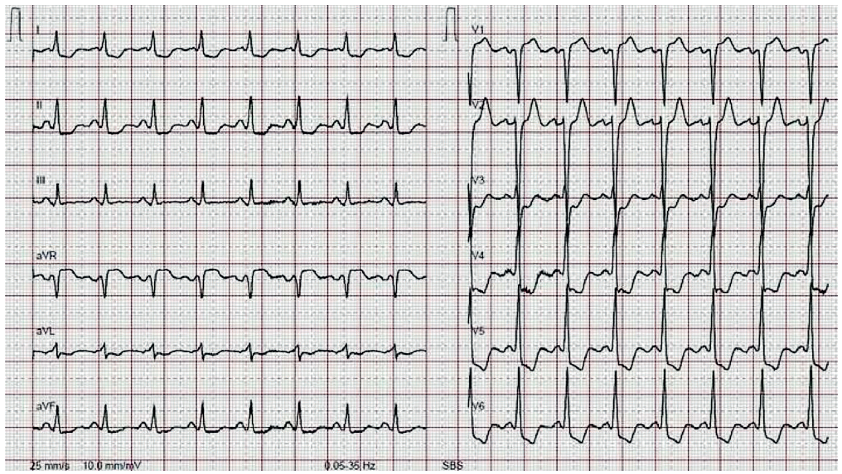 Cardiovascmed 14 00165 g001 Cardiovascmed 14 00165 g001