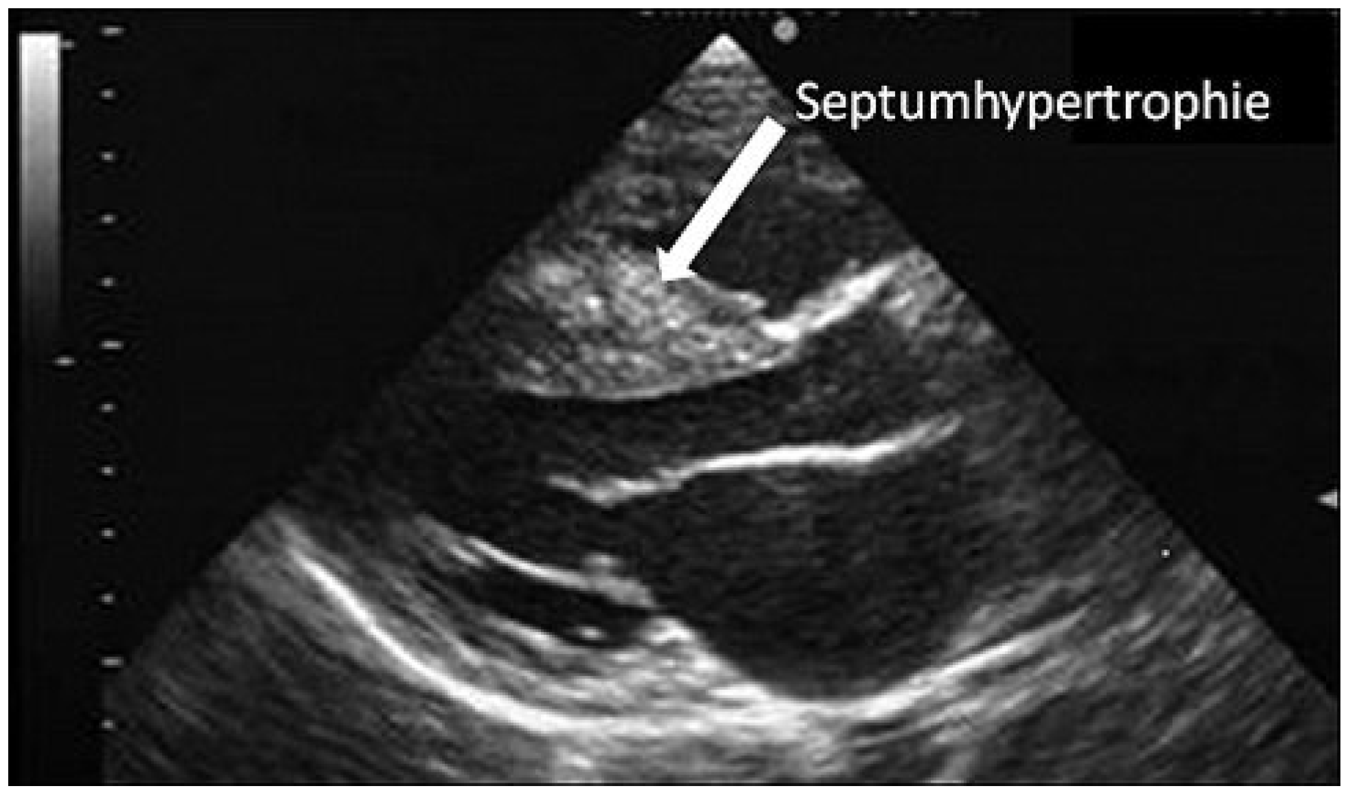 Cardiovascmed 14 00171 g002