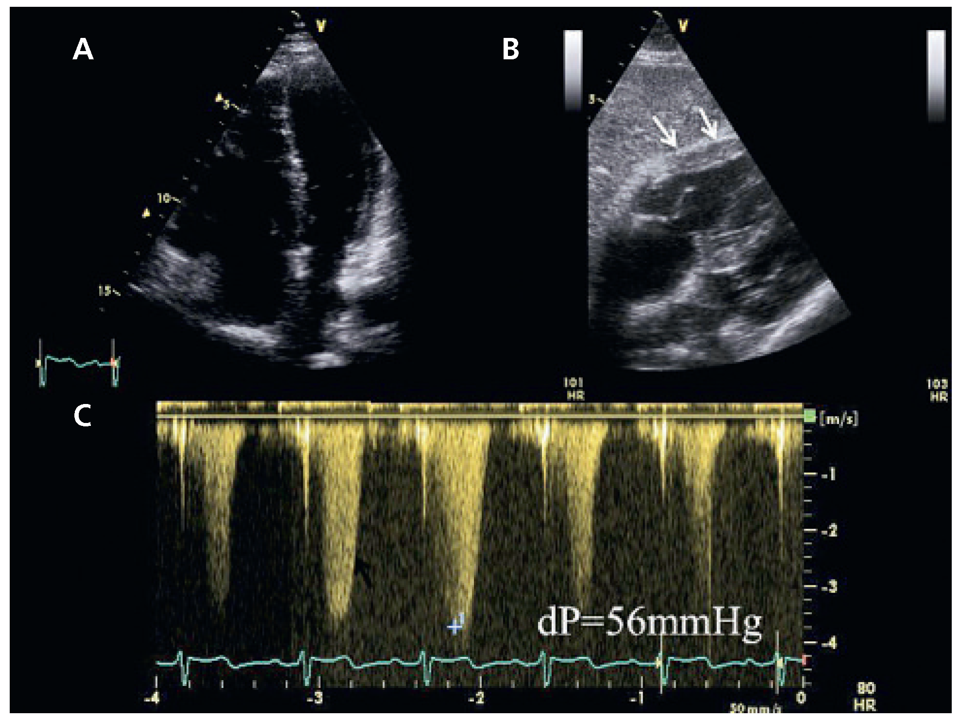 Cardiovascmed 14 00182 g001