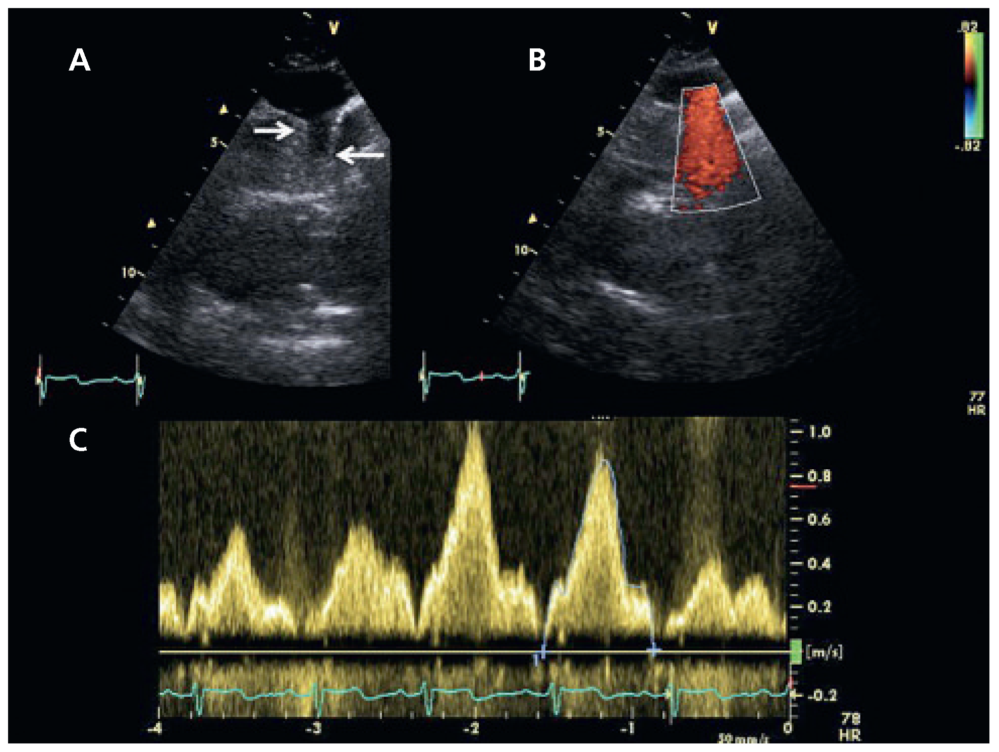 Cardiovascmed 14 00182 g003