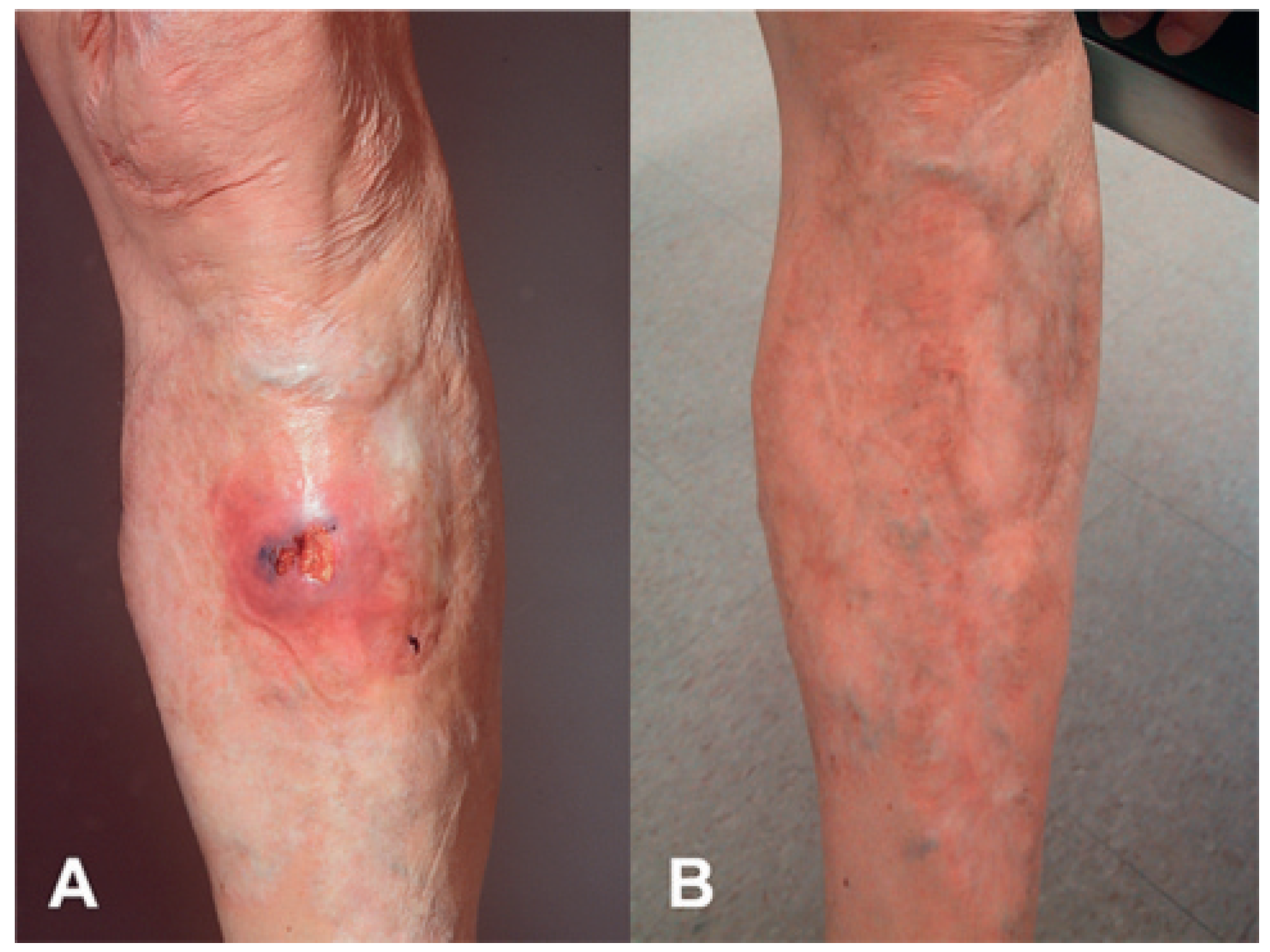 Cardiovascmed 14 00185 g001