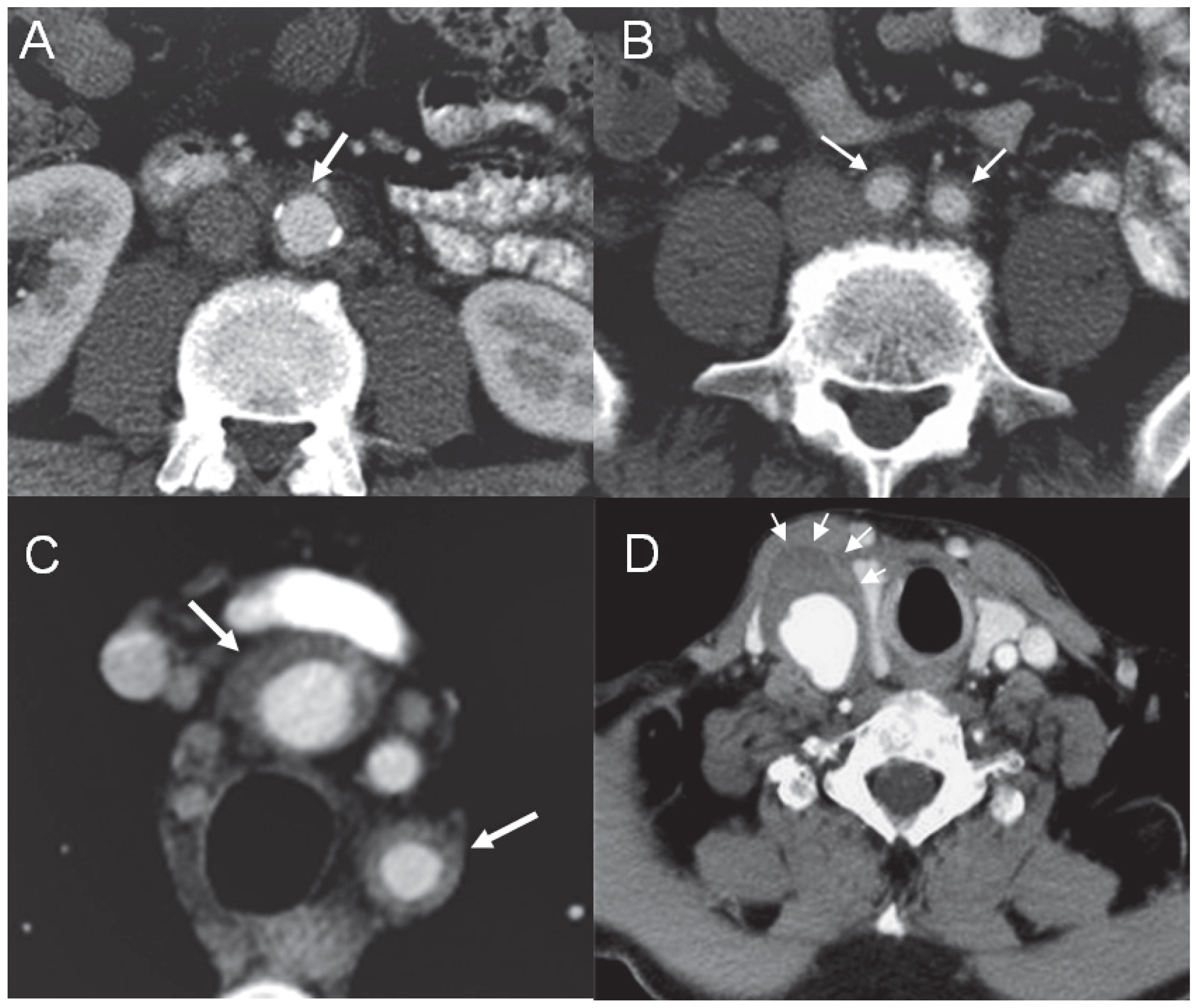 Cardiovascmed 14 00185 g002