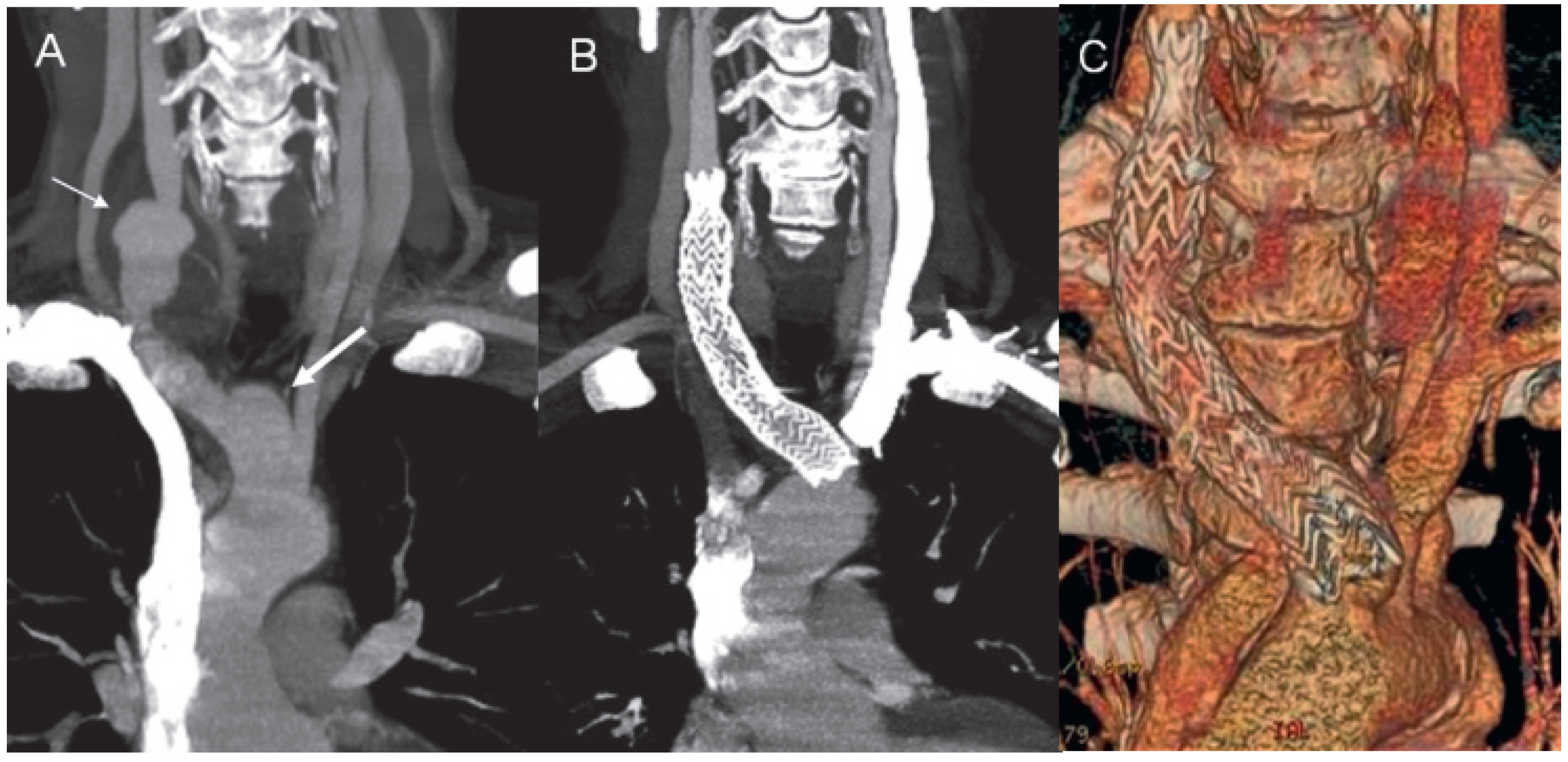 Cardiovascmed 14 00185 g003