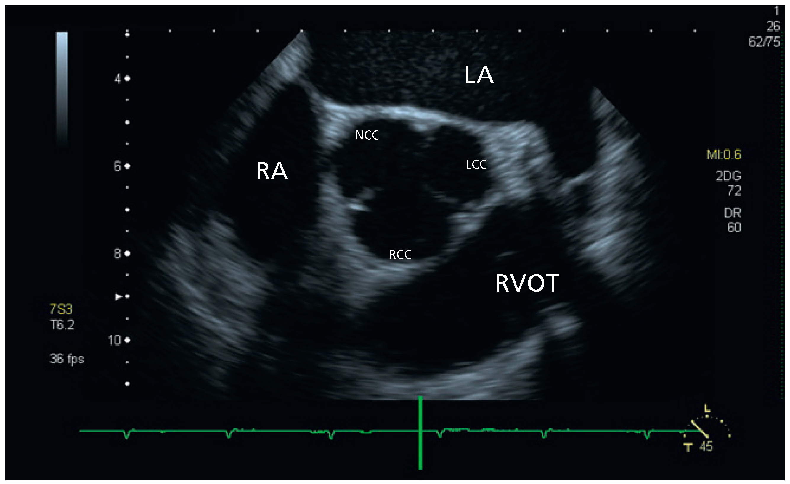 Cardiovascmed 14 00192 g001
