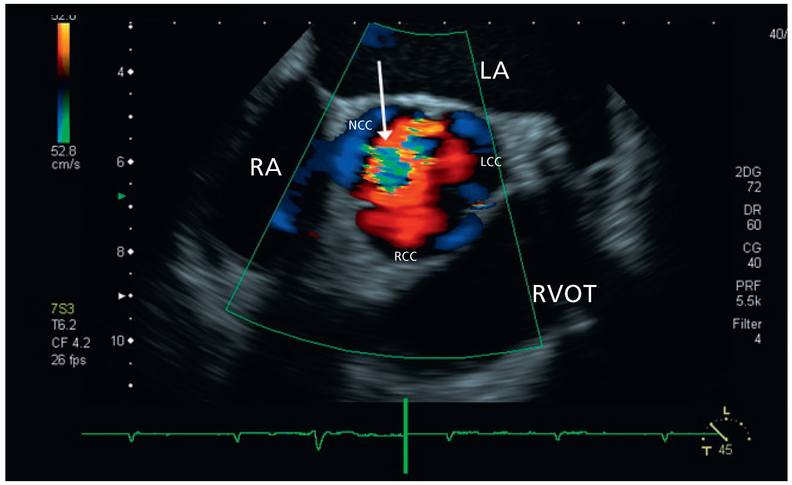 Cardiovascmed 14 00192 g002