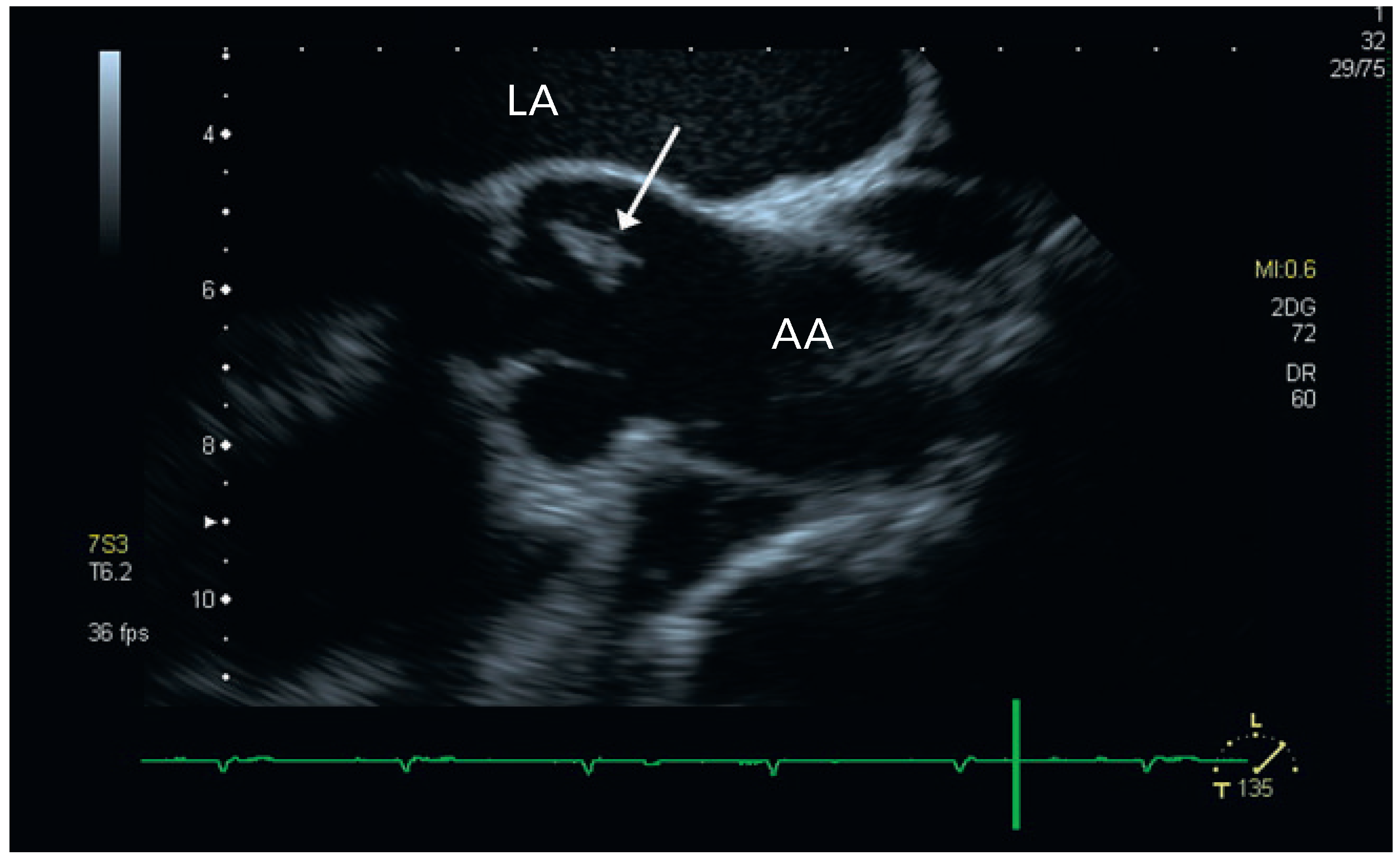 Cardiovascmed 14 00192 g004