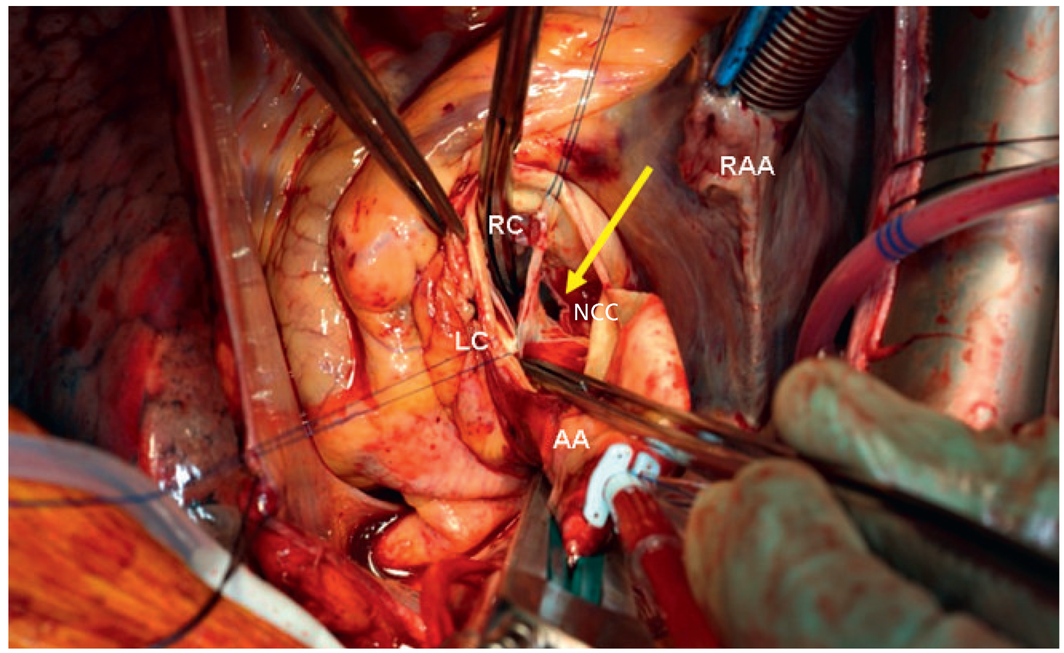 Cardiovascmed 14 00192 g006