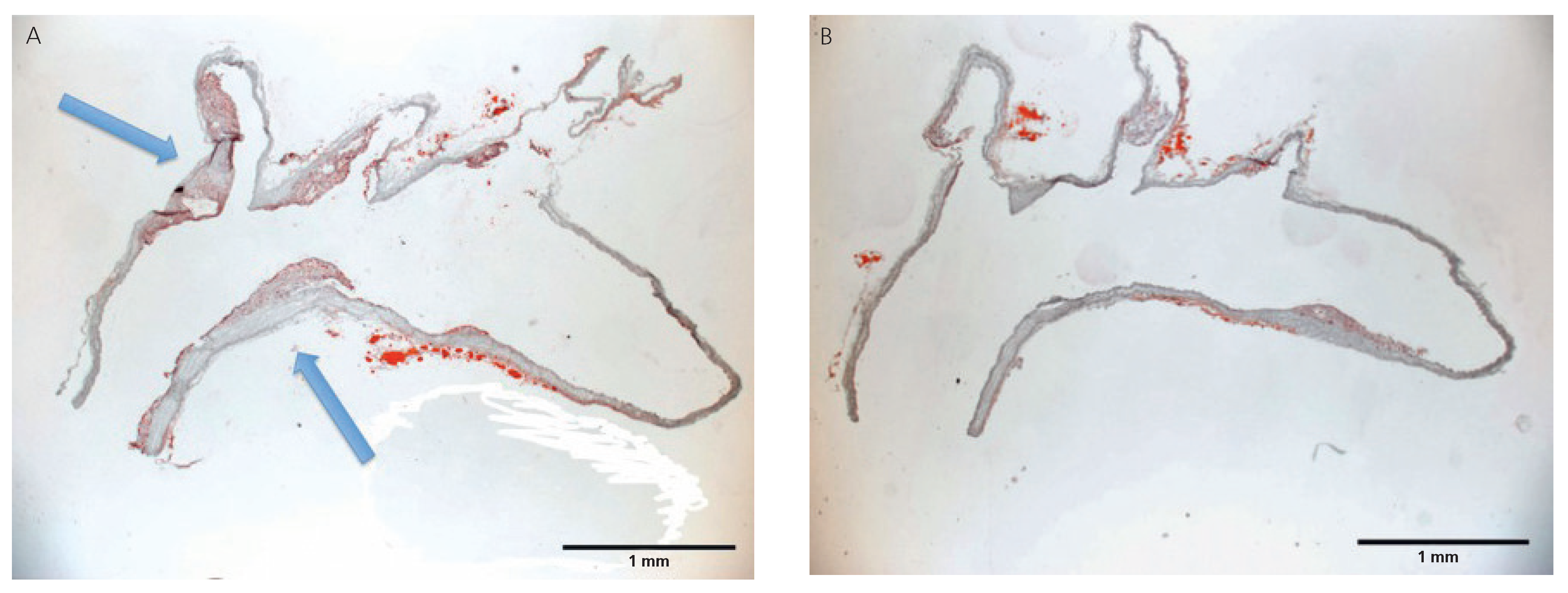 Cardiovascmed 14 00205 g003 Cardiovascmed 14 00205 g003