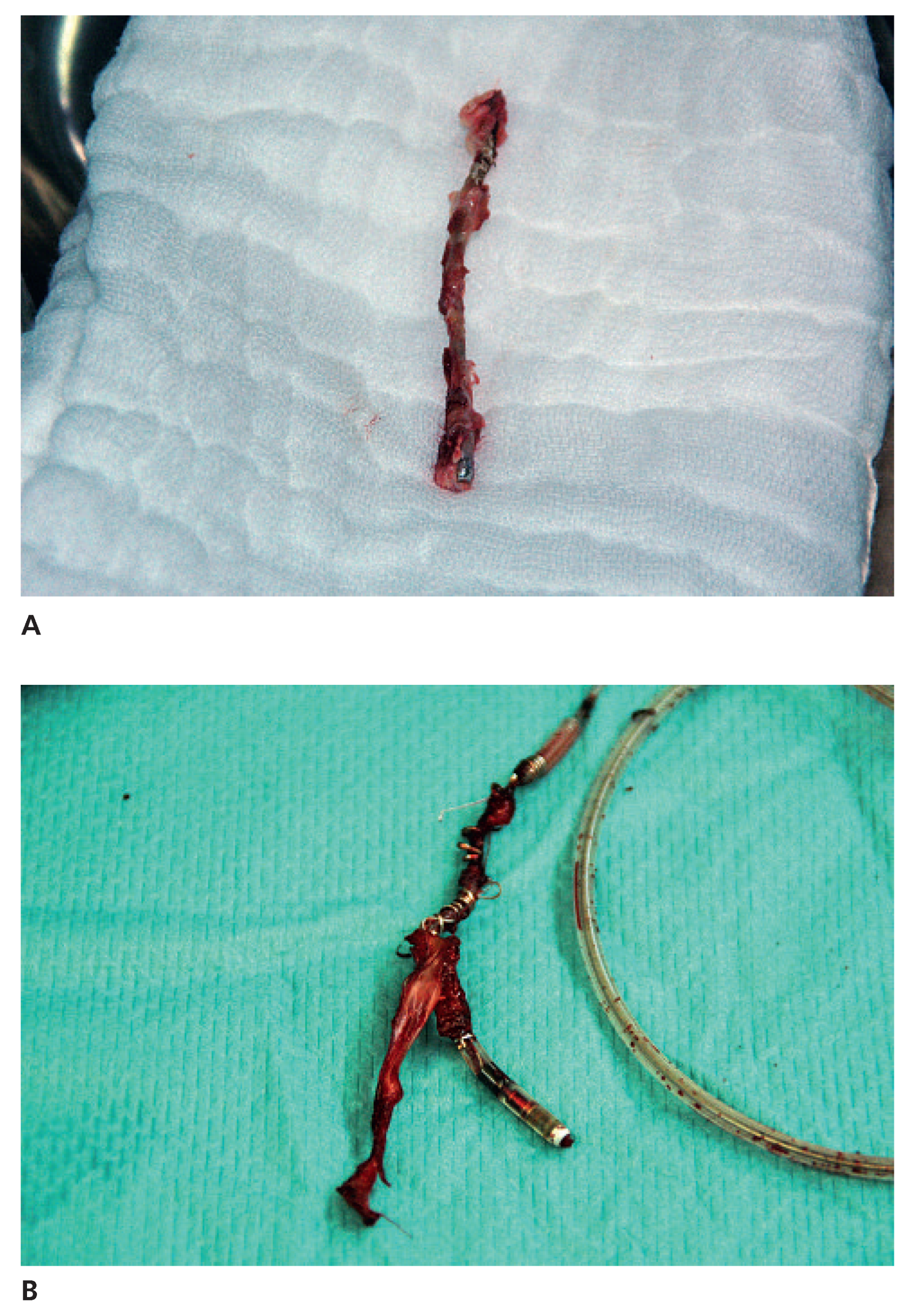 Cardiovascmed 14 00213 g001 Cardiovascmed 14 00213 g001