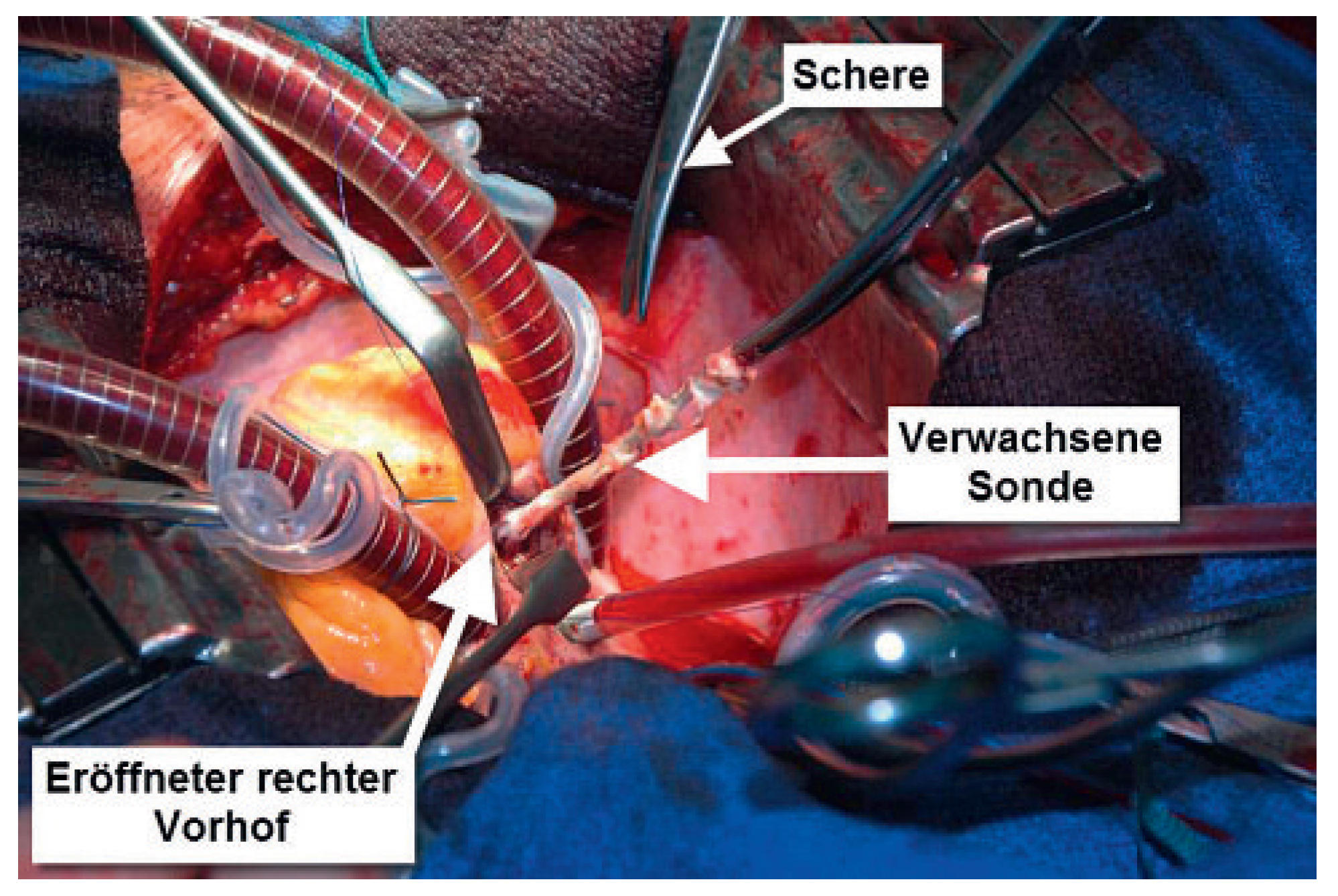 Cardiovascmed 14 00213 g002 Cardiovascmed 14 00213 g002