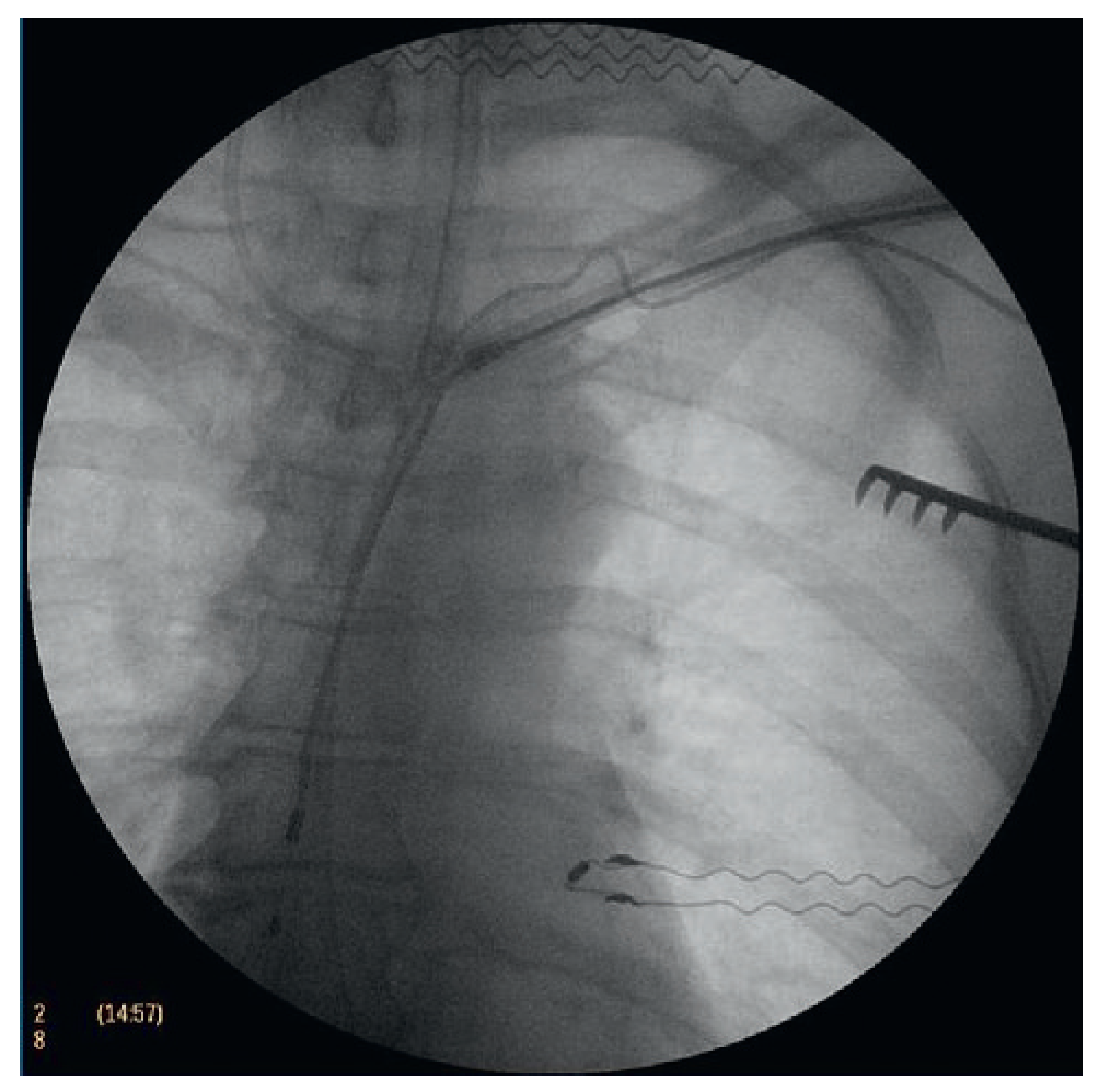 Cardiovascmed 14 00213 g003 Cardiovascmed 14 00213 g003