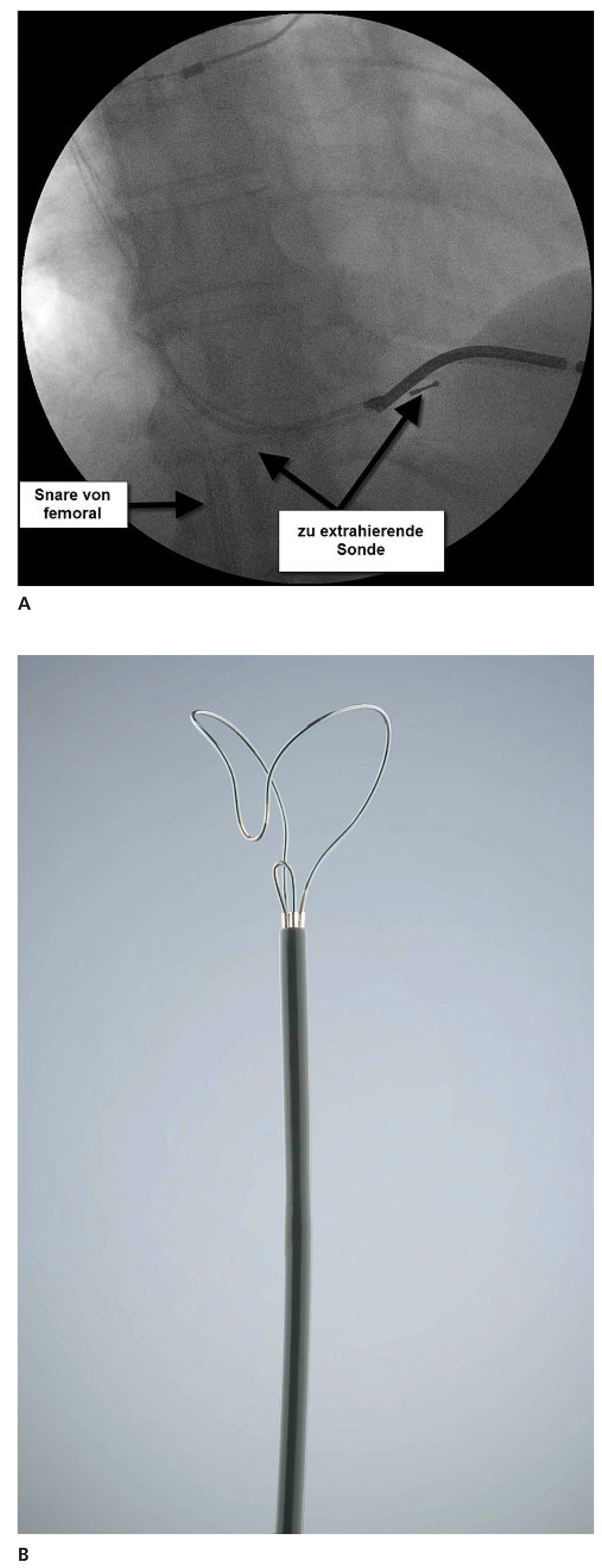 Cardiovascmed 14 00213 g006 Cardiovascmed 14 00213 g006